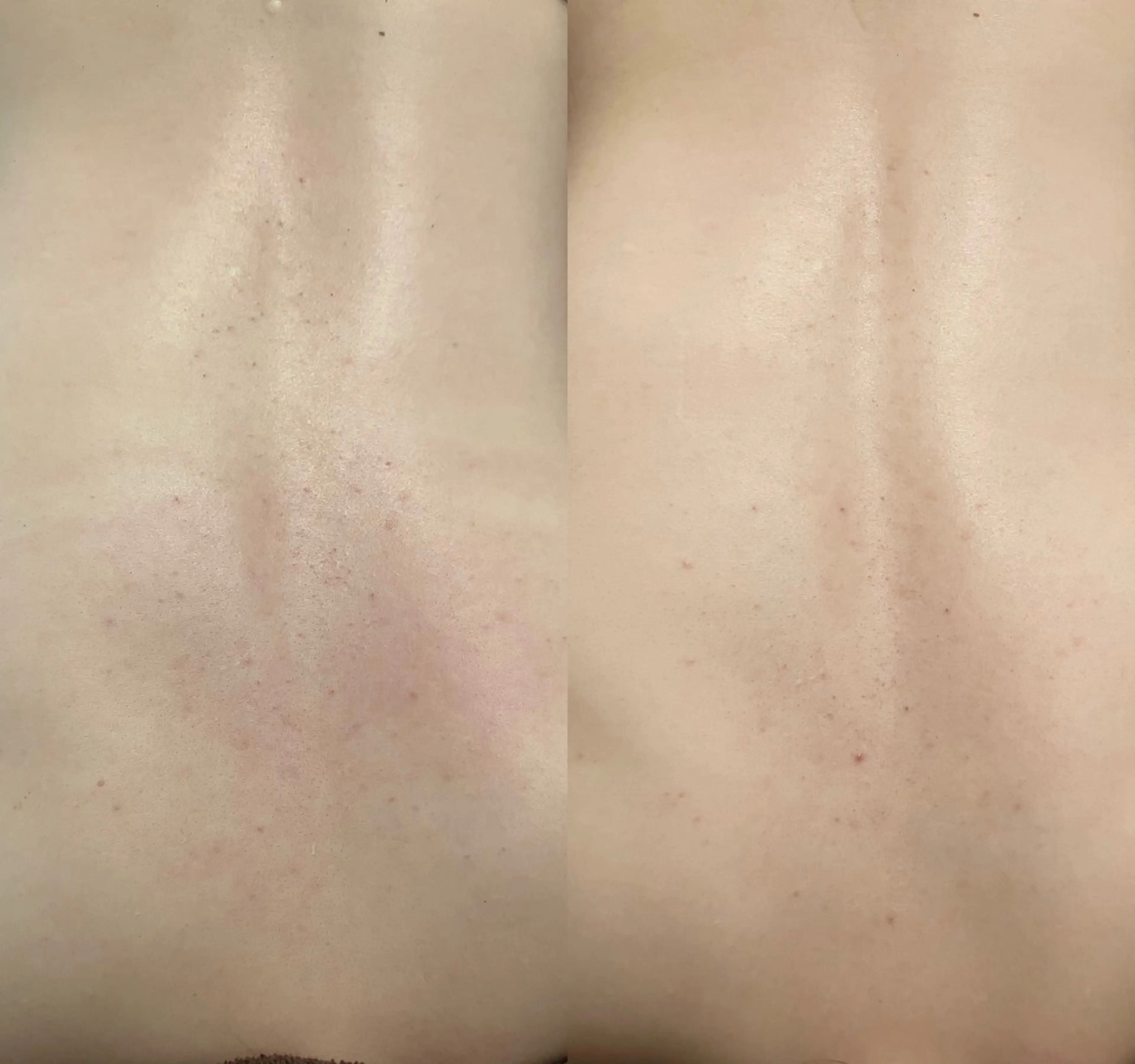 mison所属・mison 安形友花のネイルデザイン