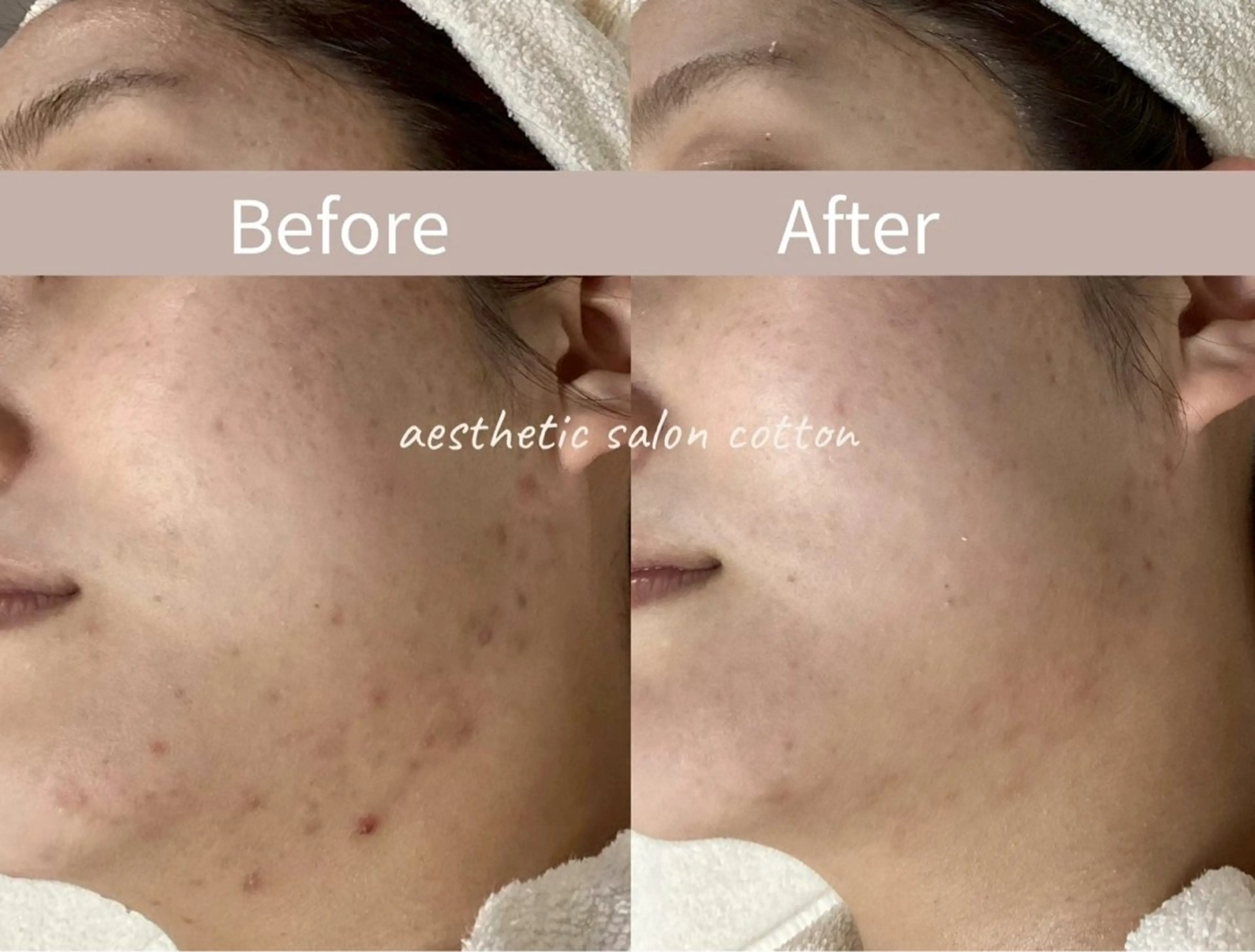 エステ 都度払い 肌質改善専門サロンのエステ・リラクイメージ