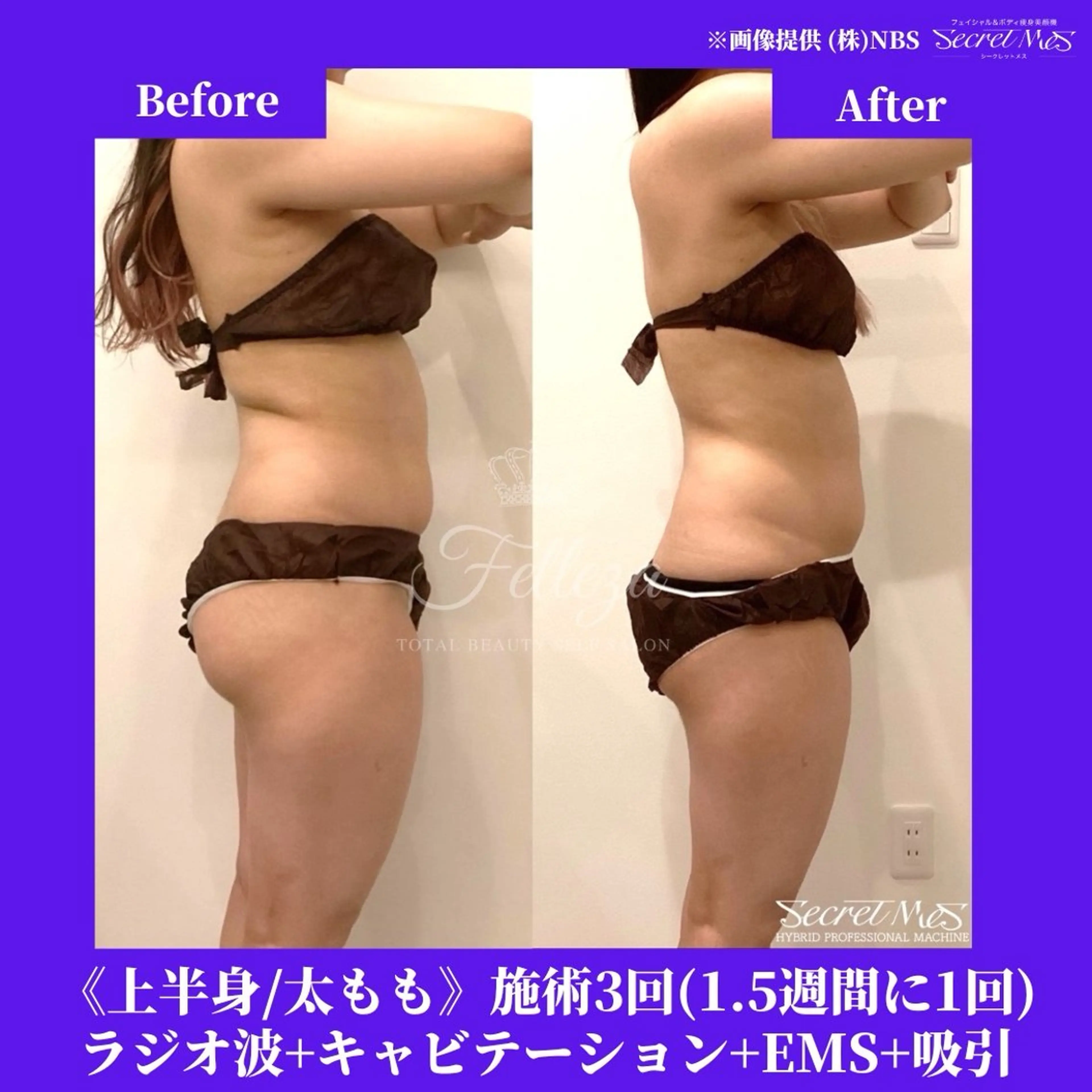 メンズ 有人型セルフサロン 脱毛／痩身／美顔のその他イメージ