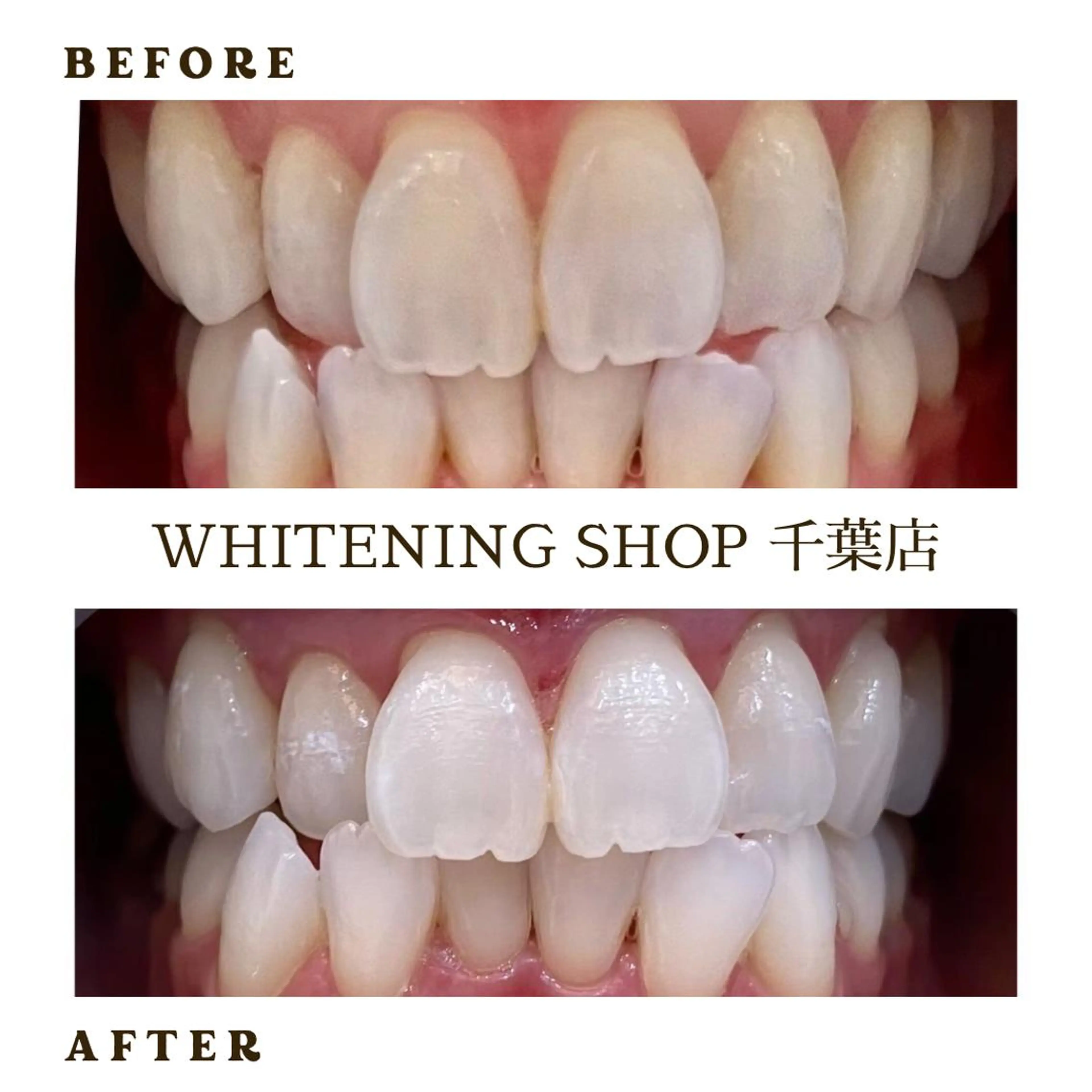 メンズ エステ ホワイトニング ショップ千葉店のその他イメージ