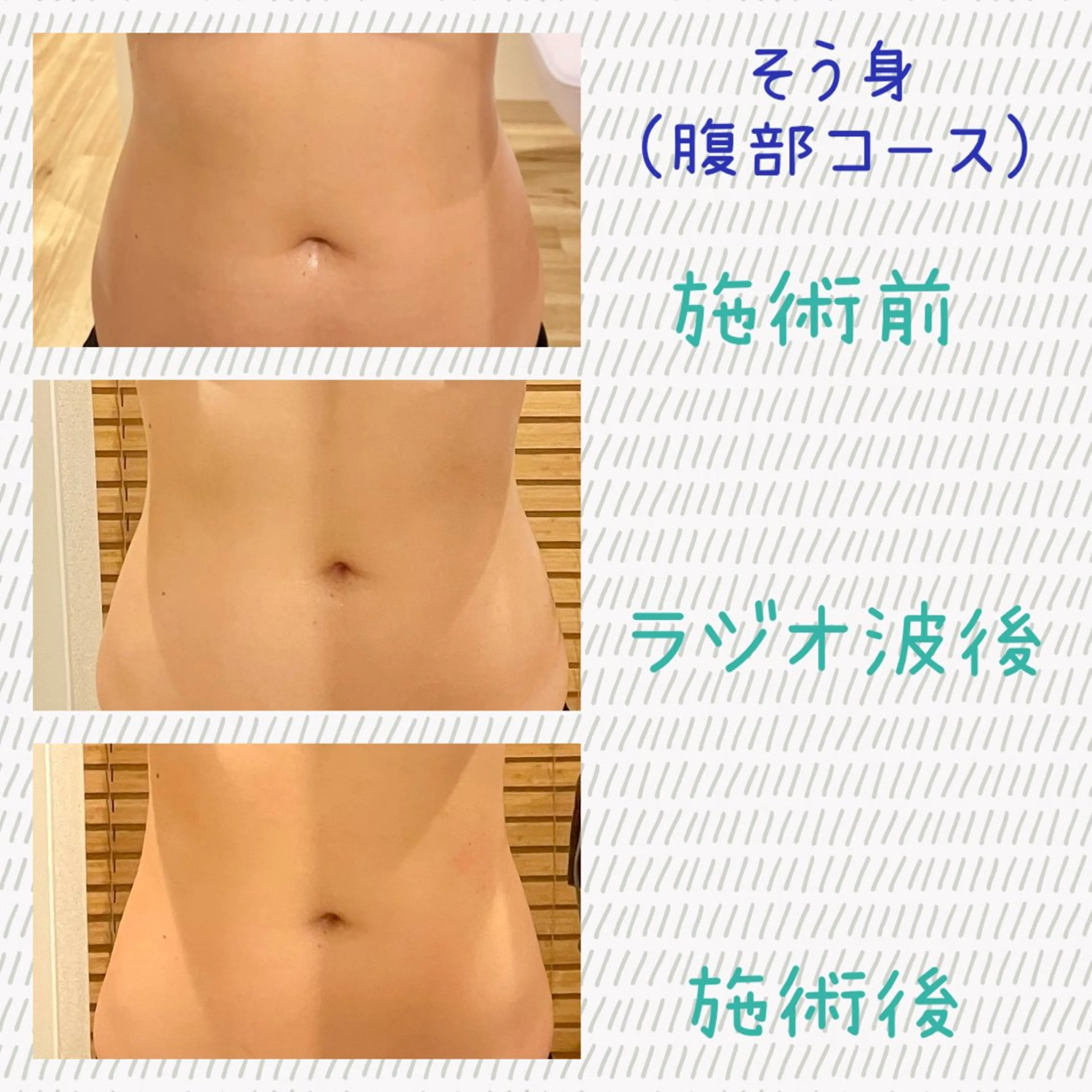 Laplace池袋本店(ラプラス池袋本店)所属・Laplace 池袋本店のその他イメージ