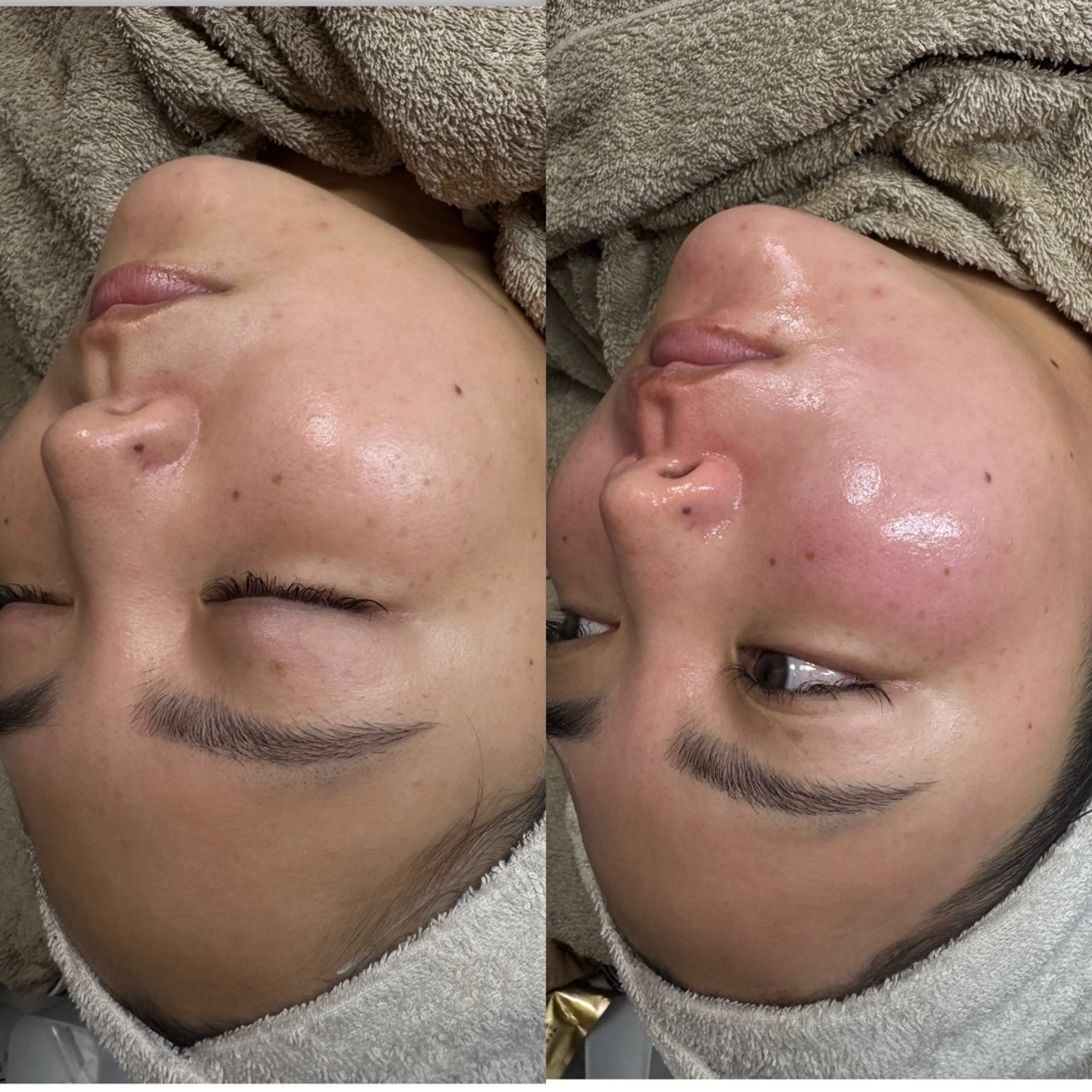 エステ yuuri. Sの眉毛・アイブロウイメージ