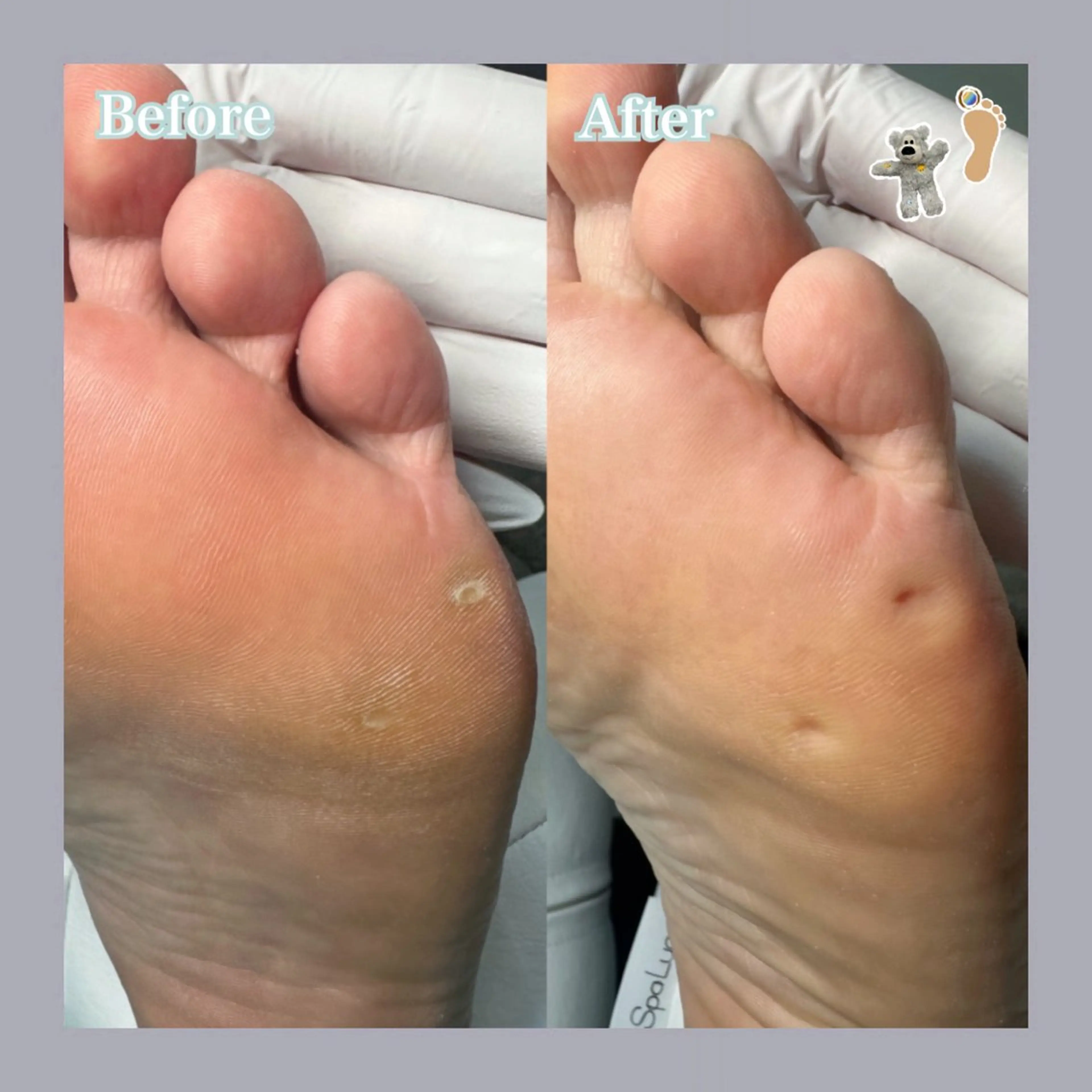 巻き爪補正店 大阪天王寺店のネイルデザイン