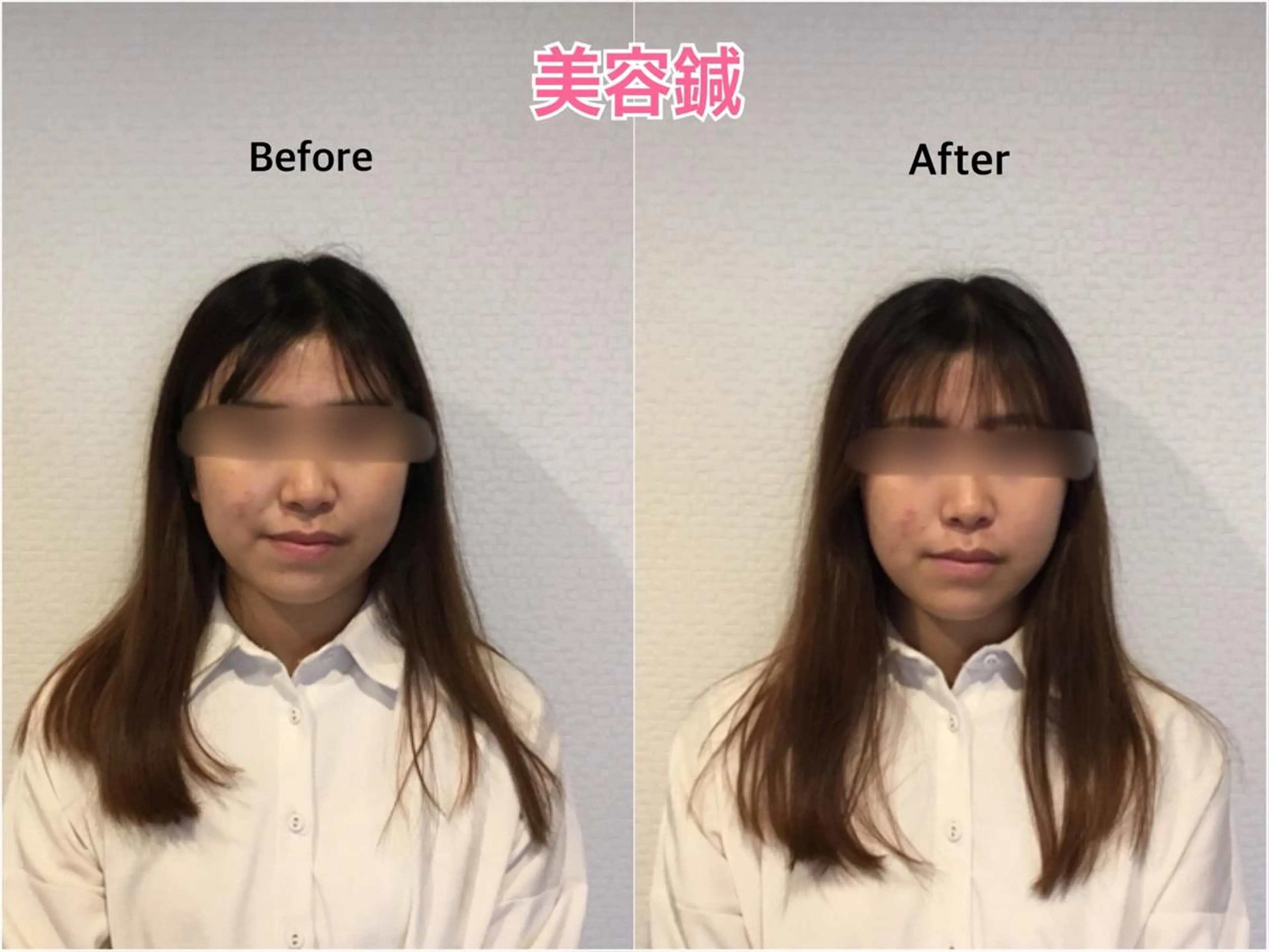 チキバン美容鍼灸整体 サロン心斎橋店のエステ・リラクイメージ