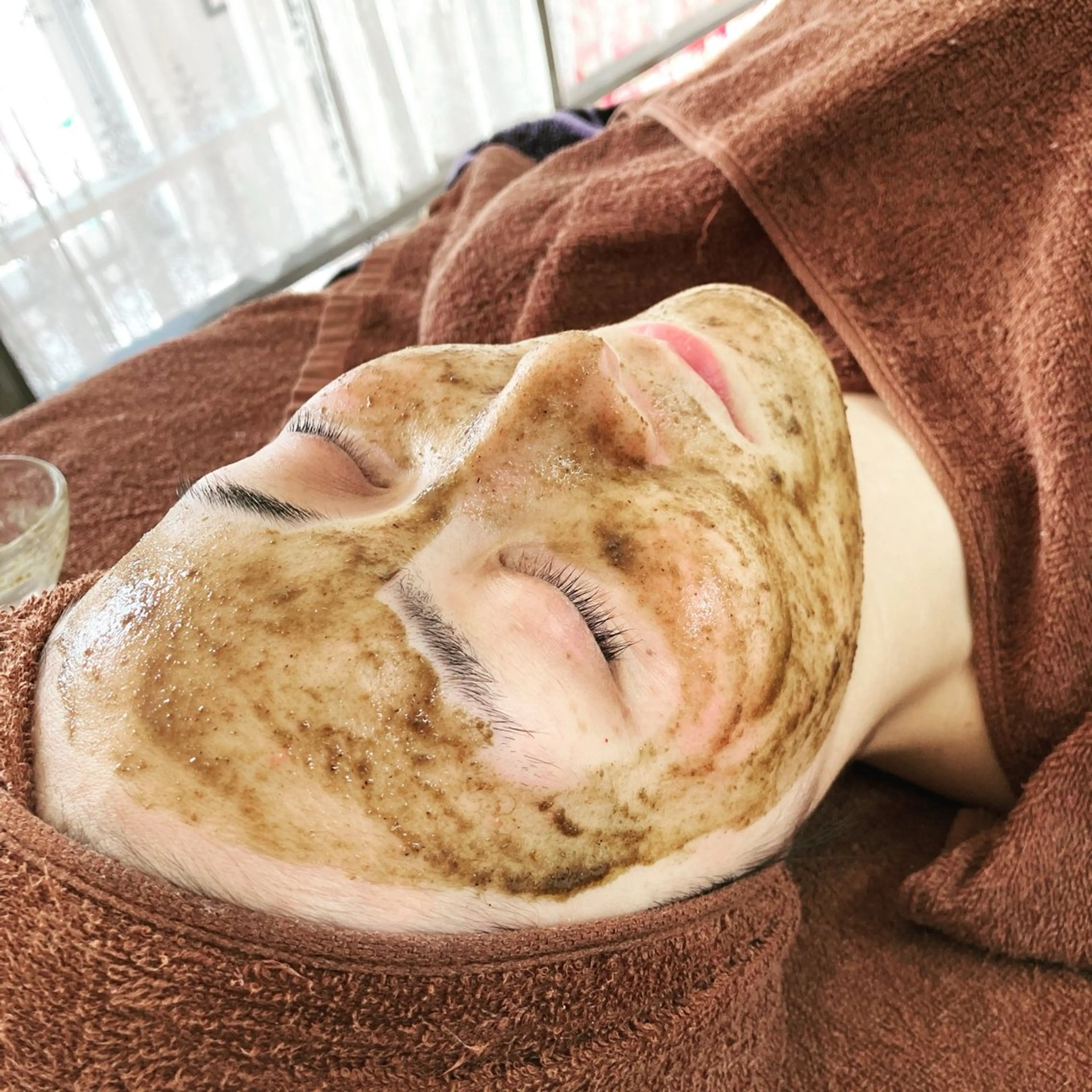 【国産ハーブピーリング】即実感🌿トラブル続きの肌に…肌艶劇的🆙ダウンタイム＆剥離なしです🎶の写真