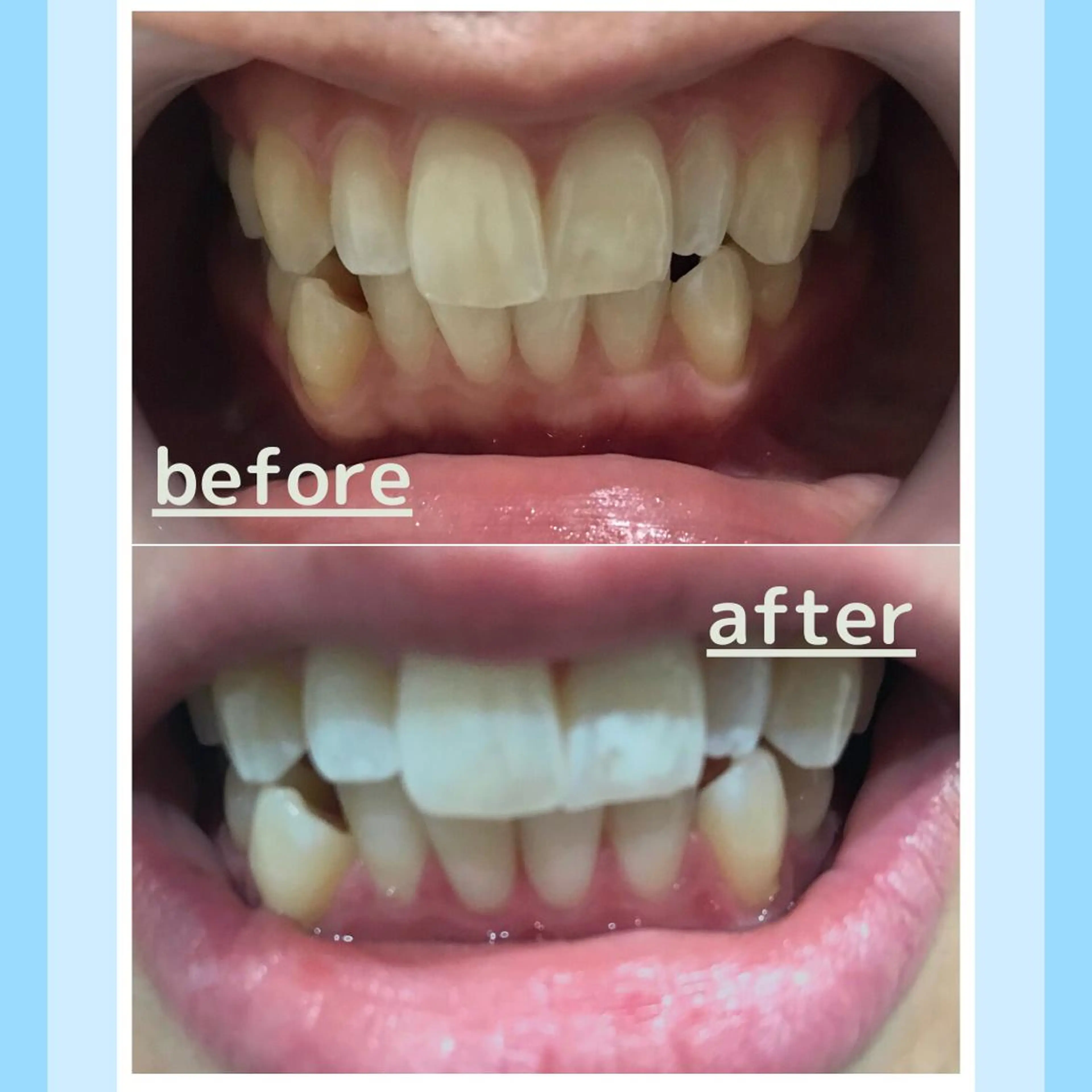 メンズ お手軽ホワイトニングsalon mina所属・武元 奈津美のその他イメージ