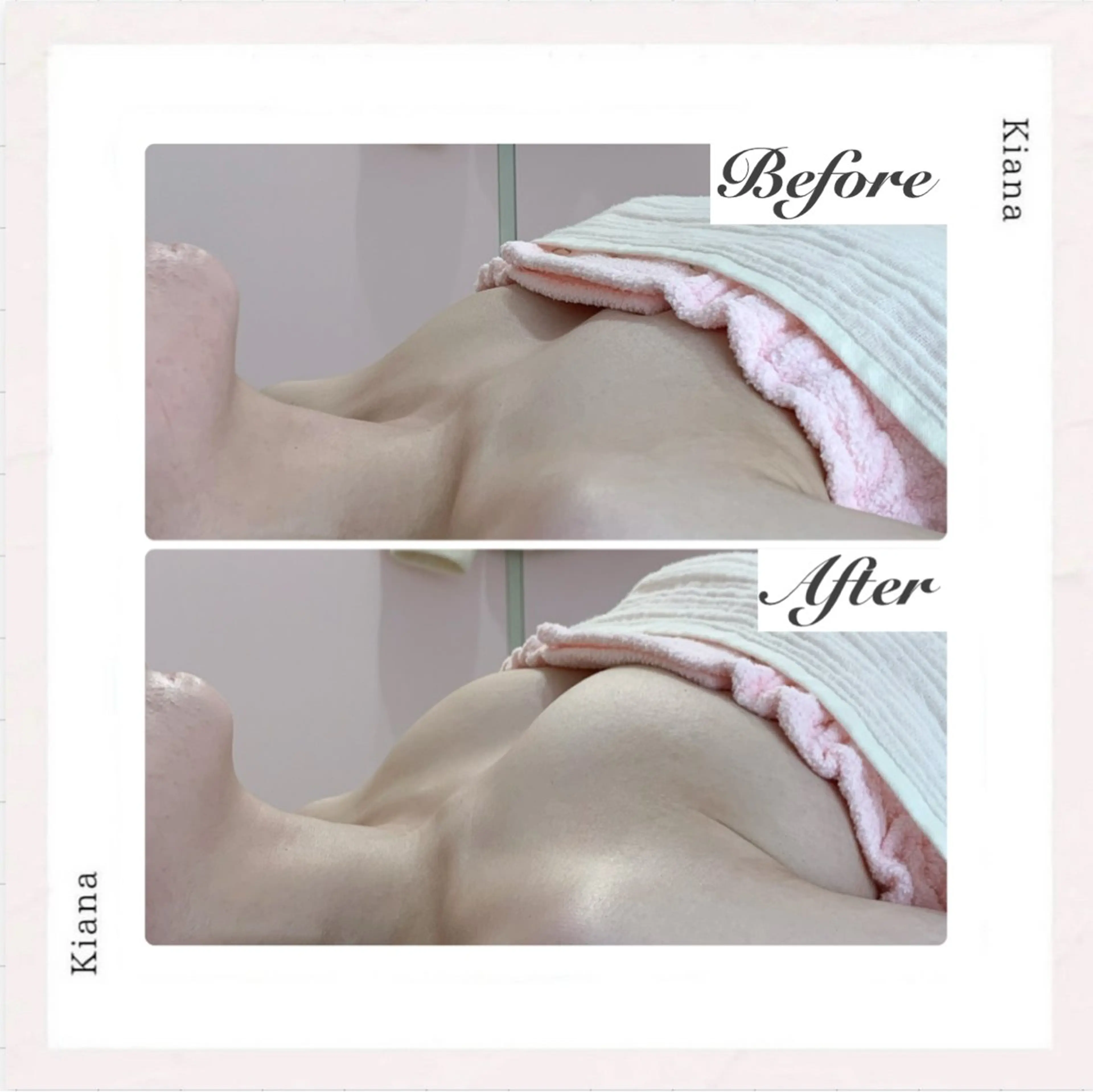 エステ リラク バスト専門Kiana 風のエステ・リラクイメージ