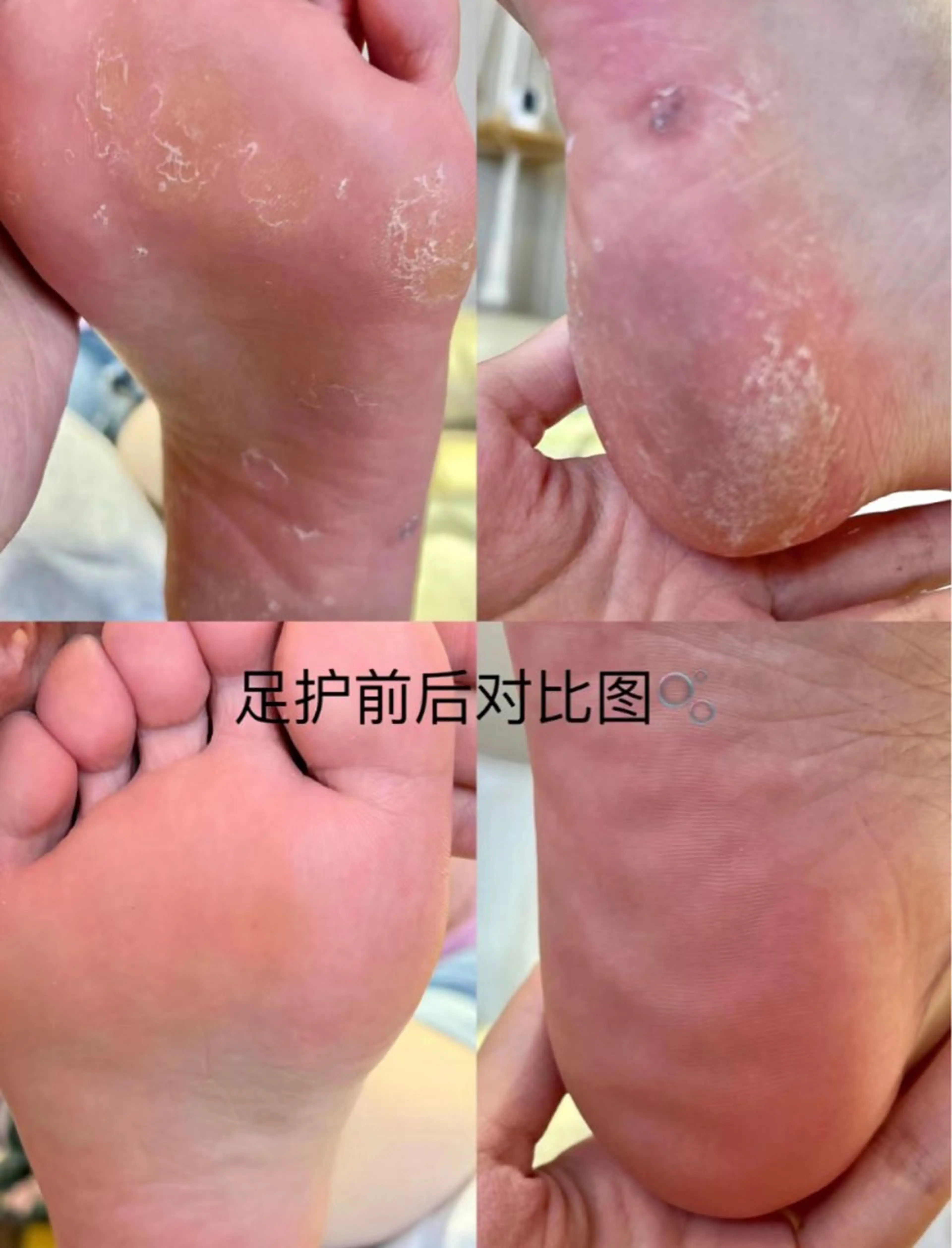 ネイル 花花 ネイルサロンのネイルデザイン