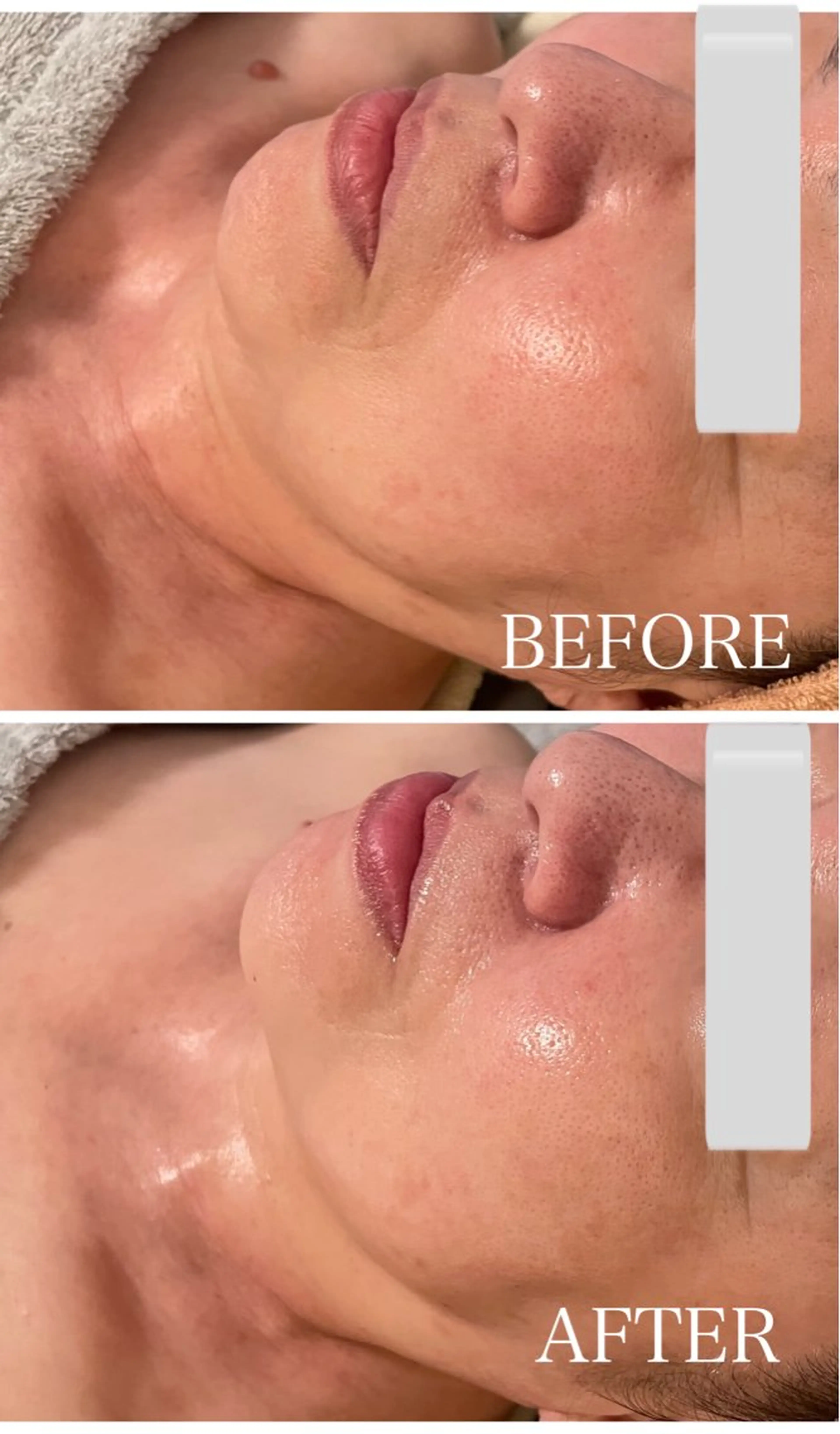 痩身小顔IRISER Akiのエステ・リラクイメージ