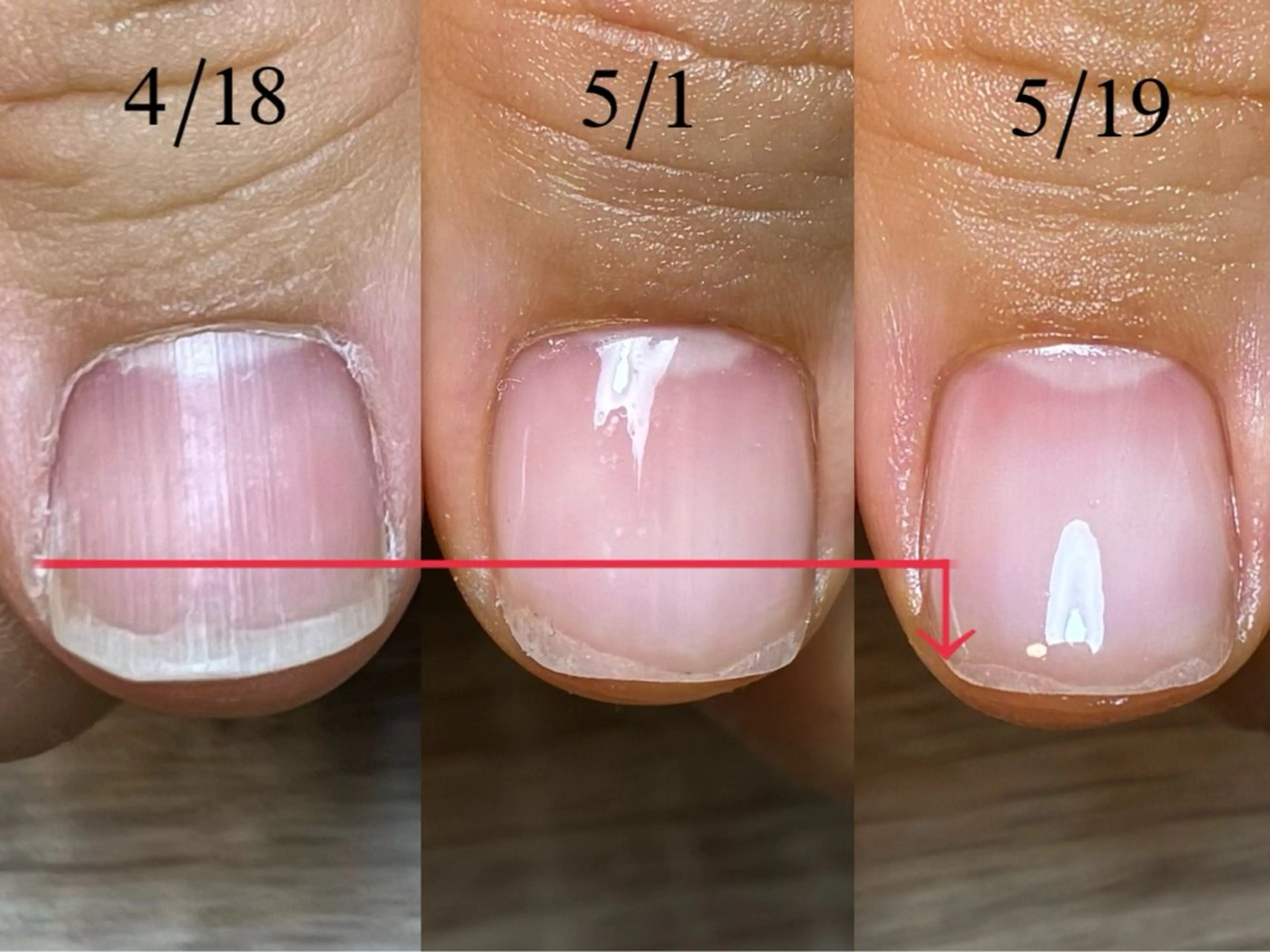 ネイル ハンドネイル ハンドケア 広島市南区(広島県) /シンプル/自爪育成のネイルデザイン