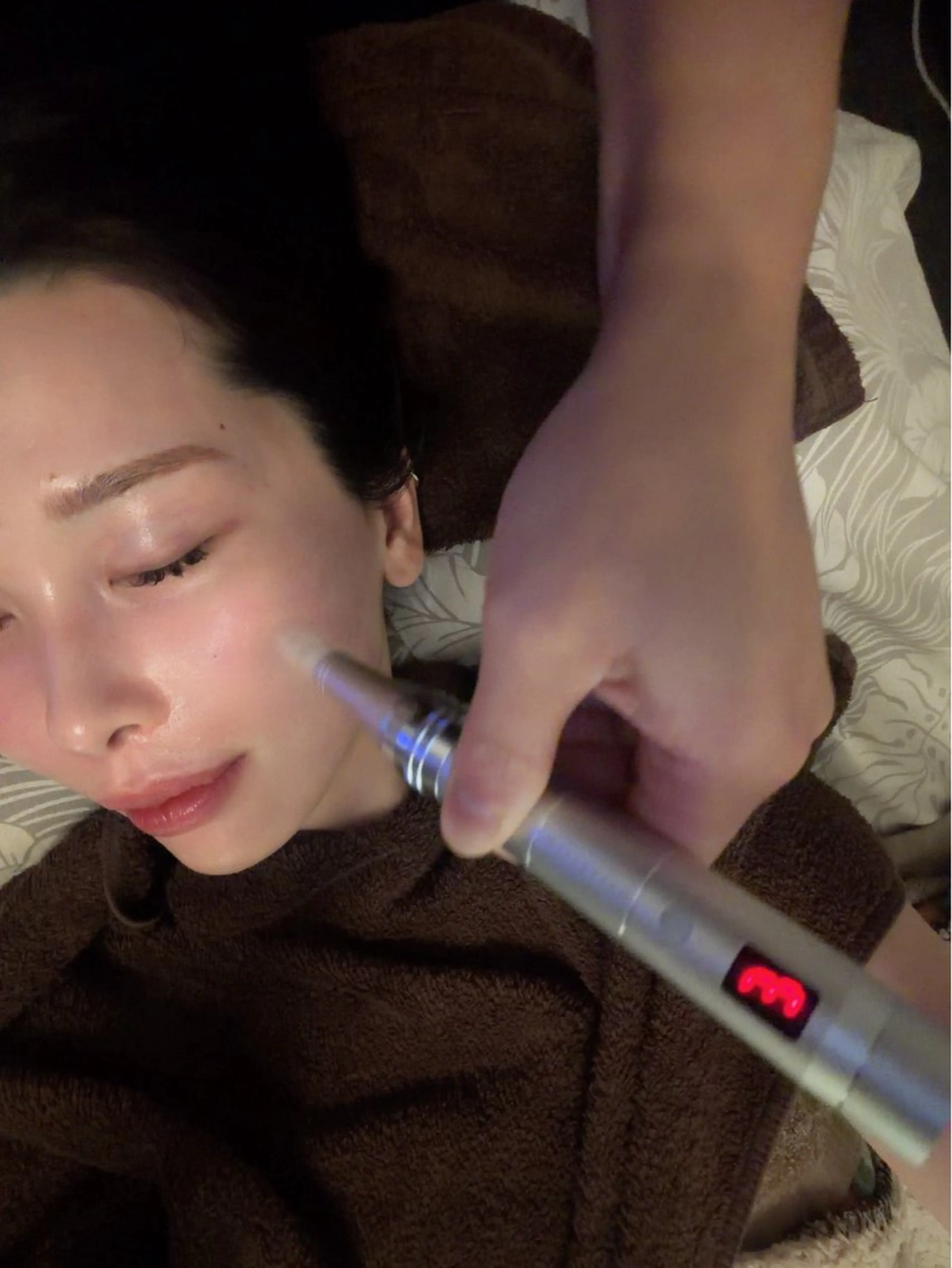 エステ 圧倒的たるみ改善 美容鍼エステのエステ・リラクイメージ