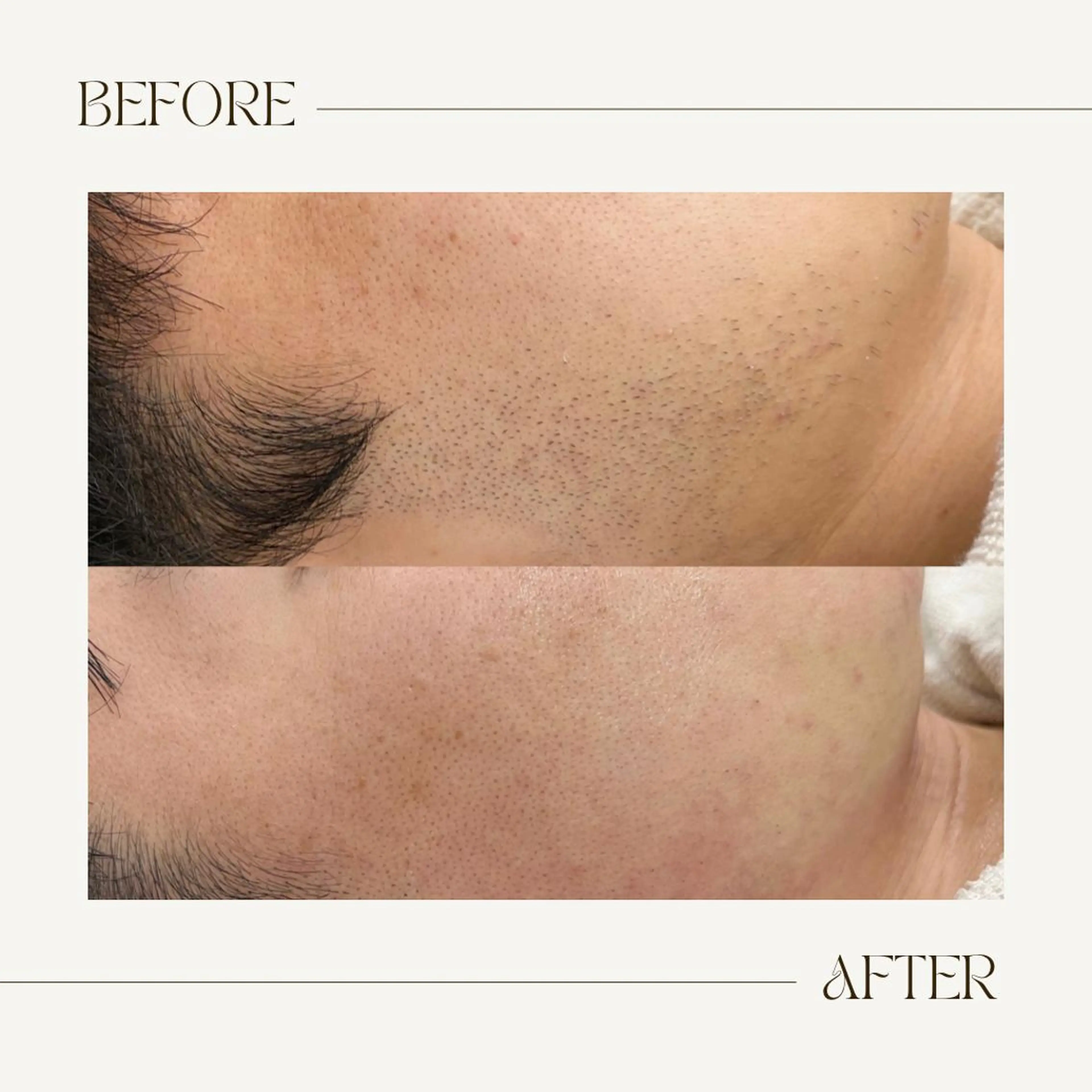 脱毛 脱毛専門サロンELIXIR（ｴﾘｸｻｰ）所属・脱毛&ホワイトニング ELIXIR×ULTのエステ・リラクイメージ