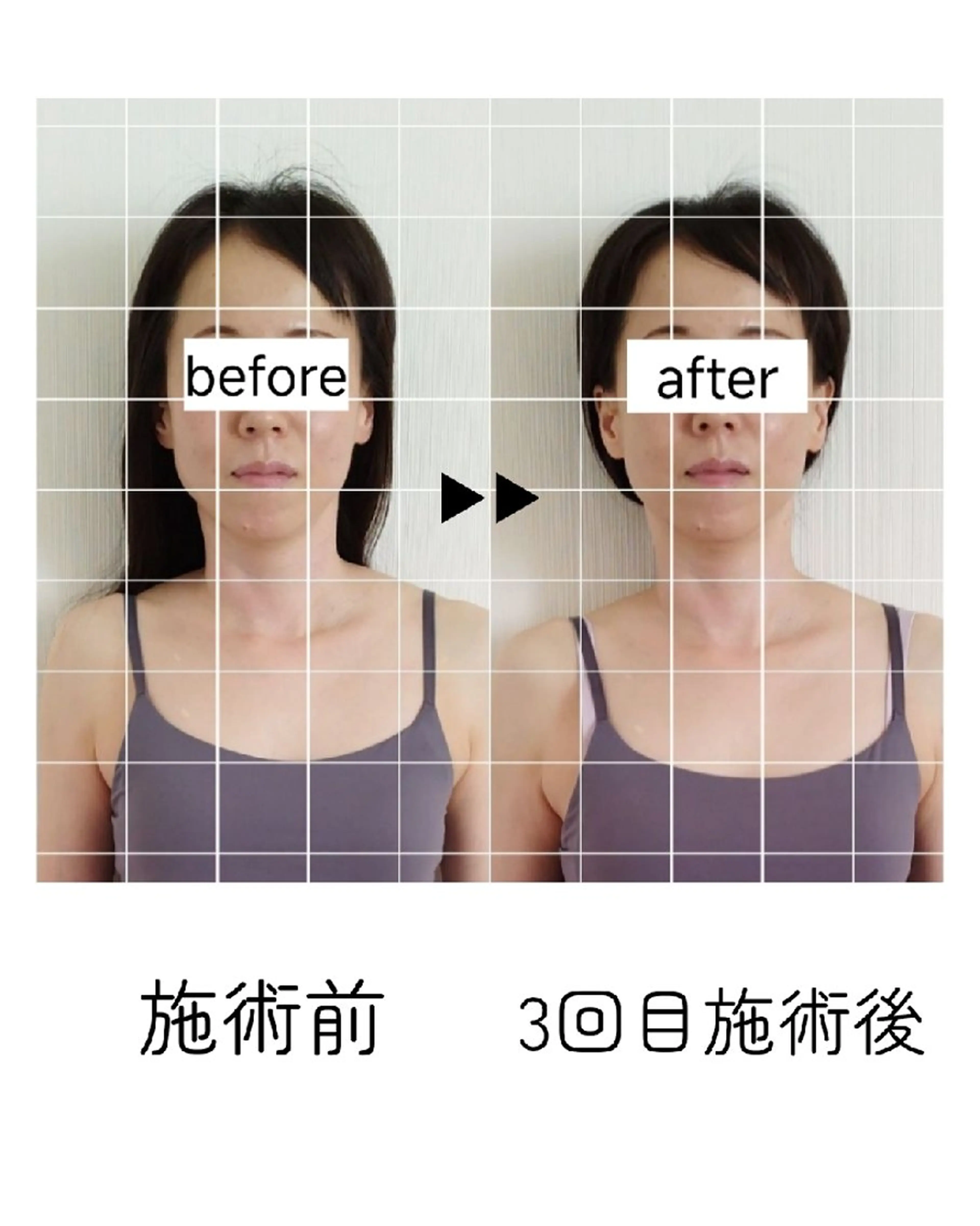 エステ リラク 桜井市｜小顔・ 美容矯正 madoiのエステ・リラクイメージ