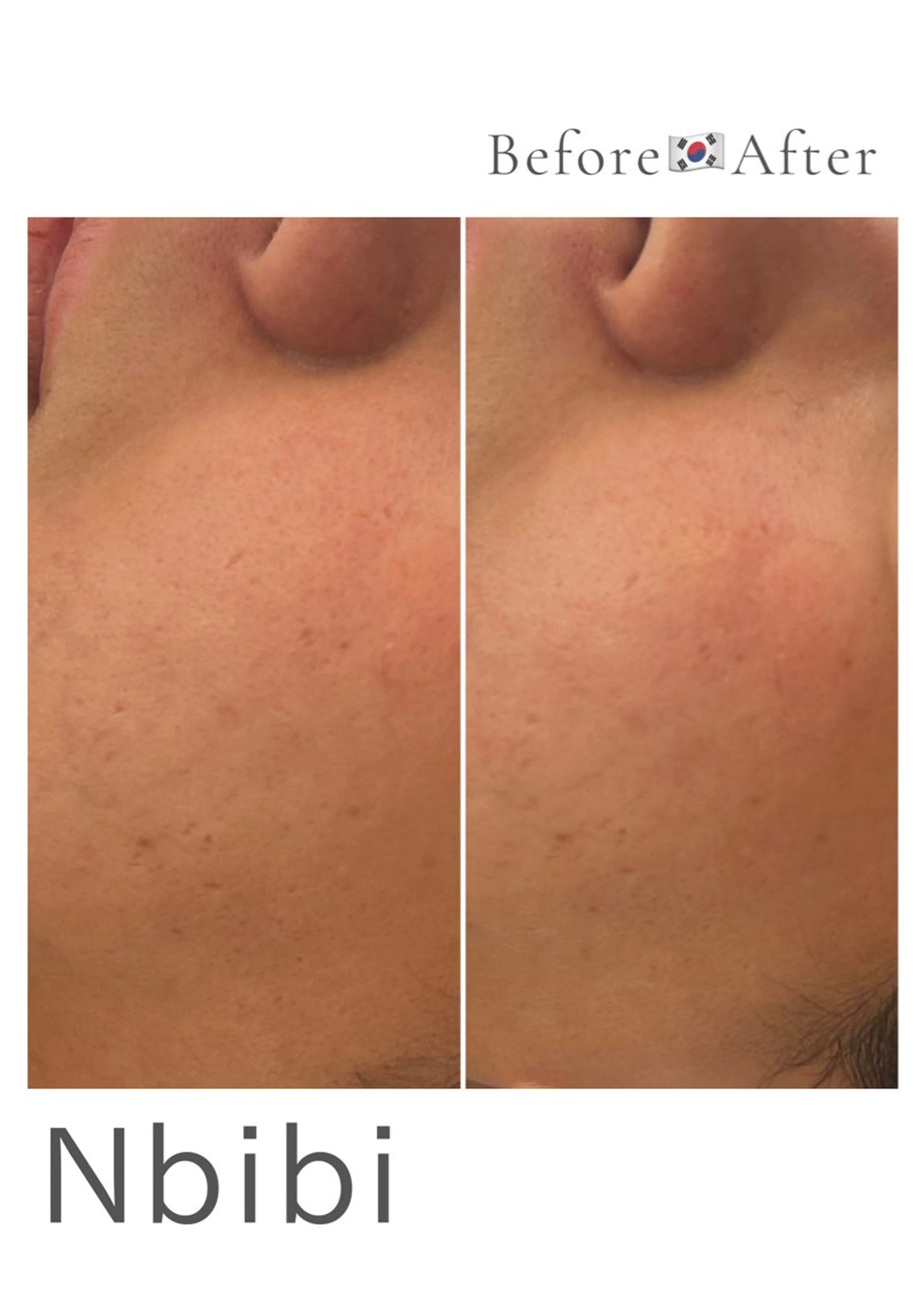 エステ 韓国🇰🇷価格 サロン_Nbibiのエステ・リラクイメージ