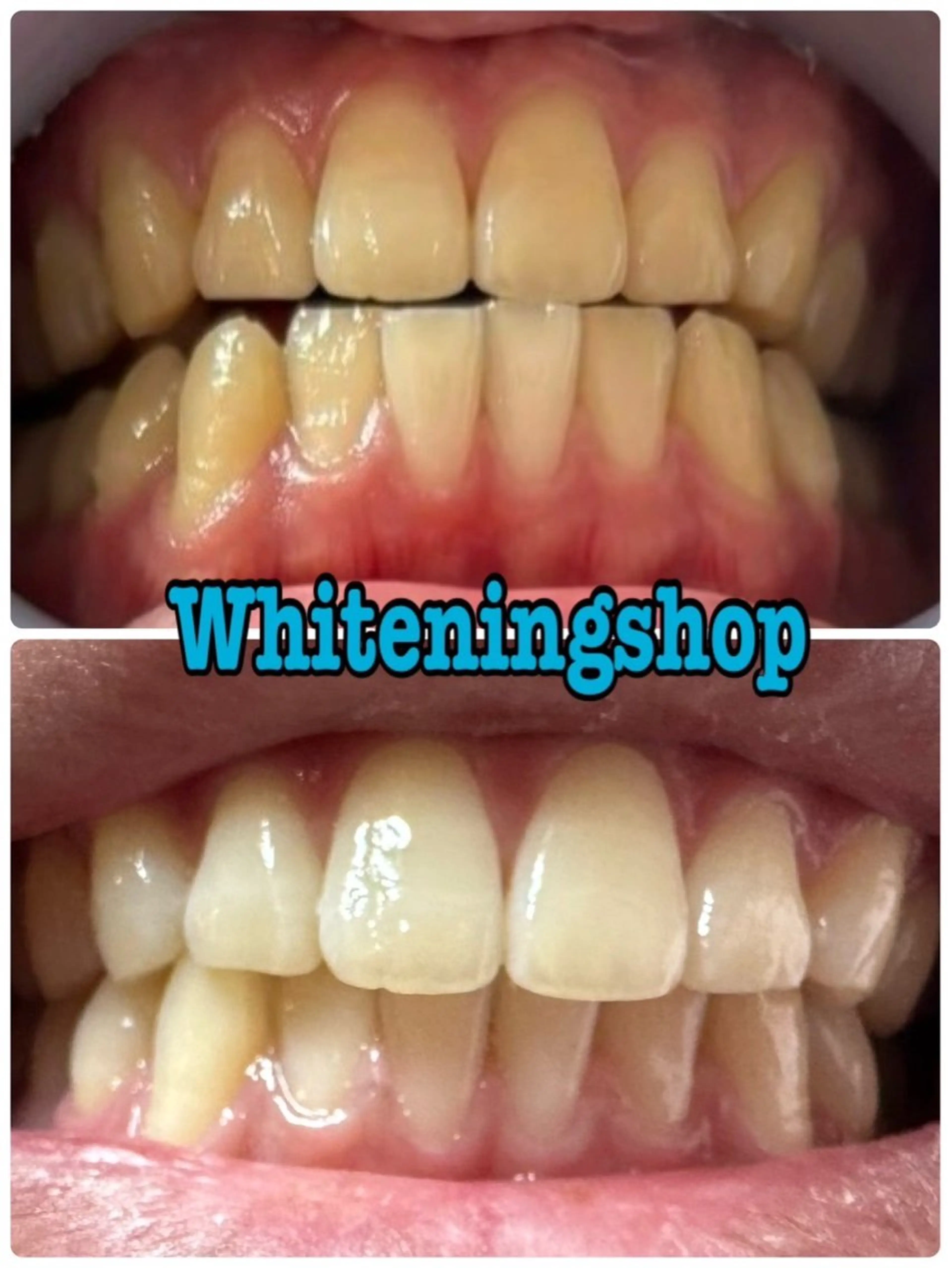 ホワイトニングショップ伊丹店所属・ホワイトニング ショップ伊丹店のその他イメージ