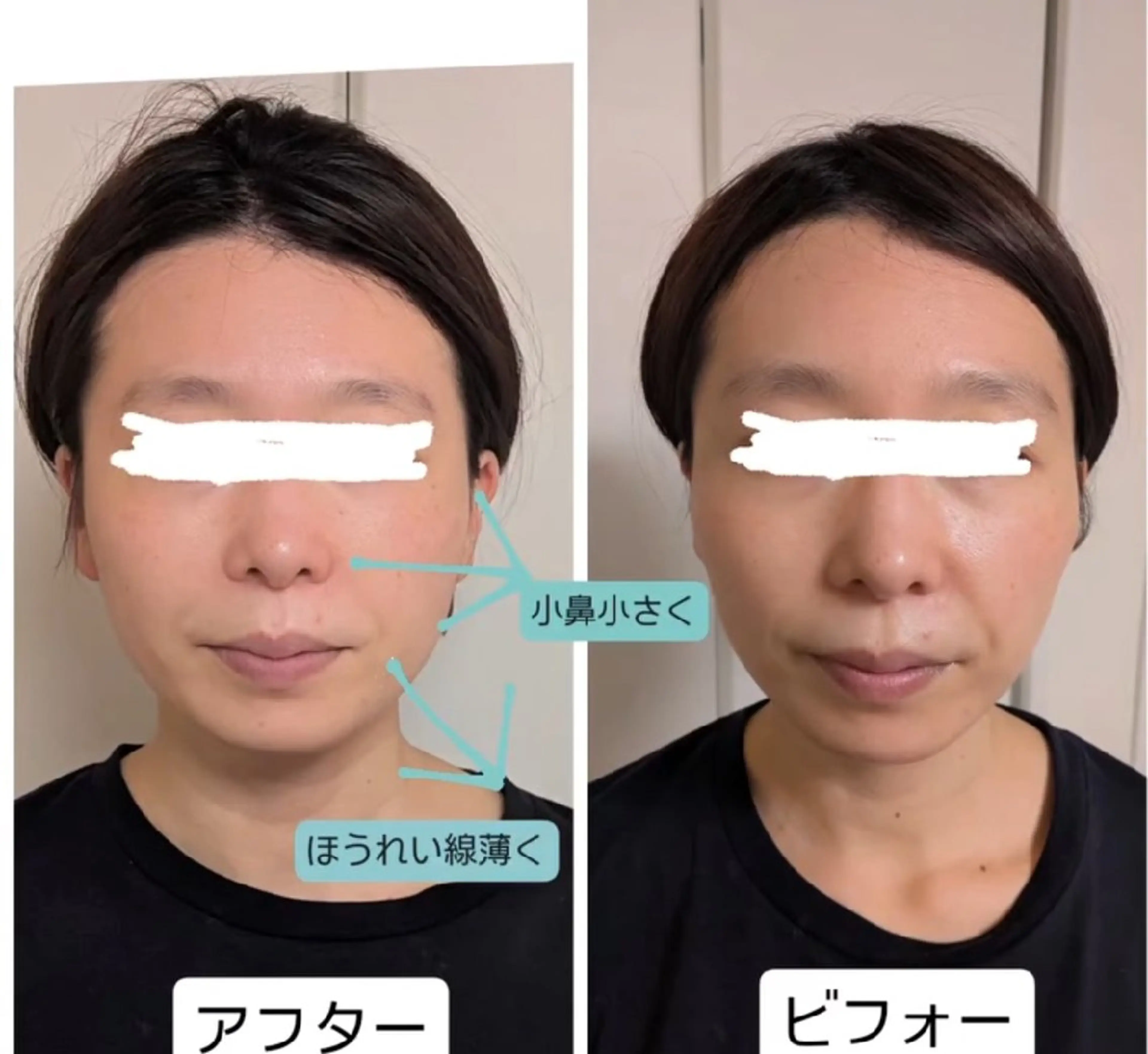 小顔 カリーナのエステ・リラクイメージ