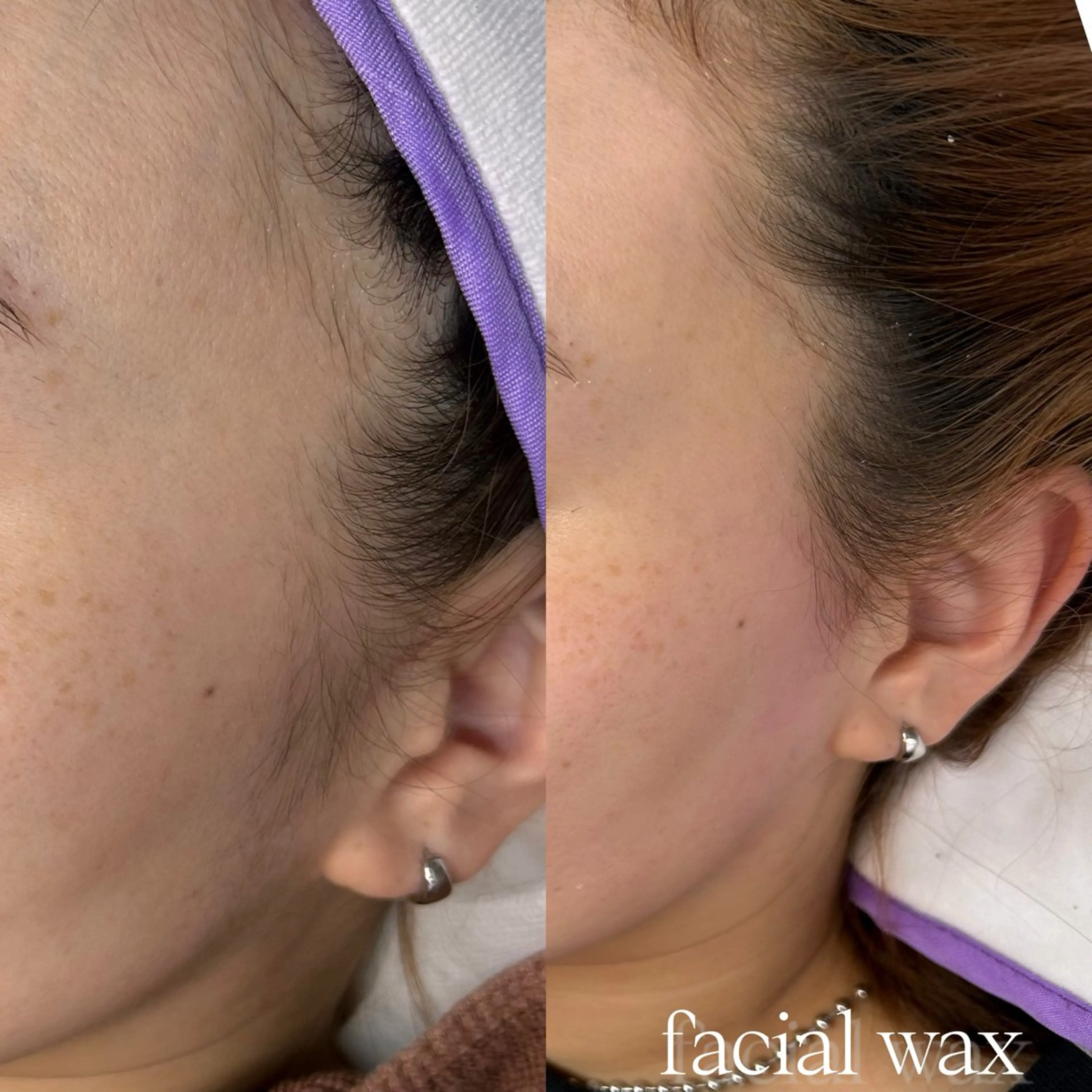 速攻ツヤ肌フェイシャルwaxの写真