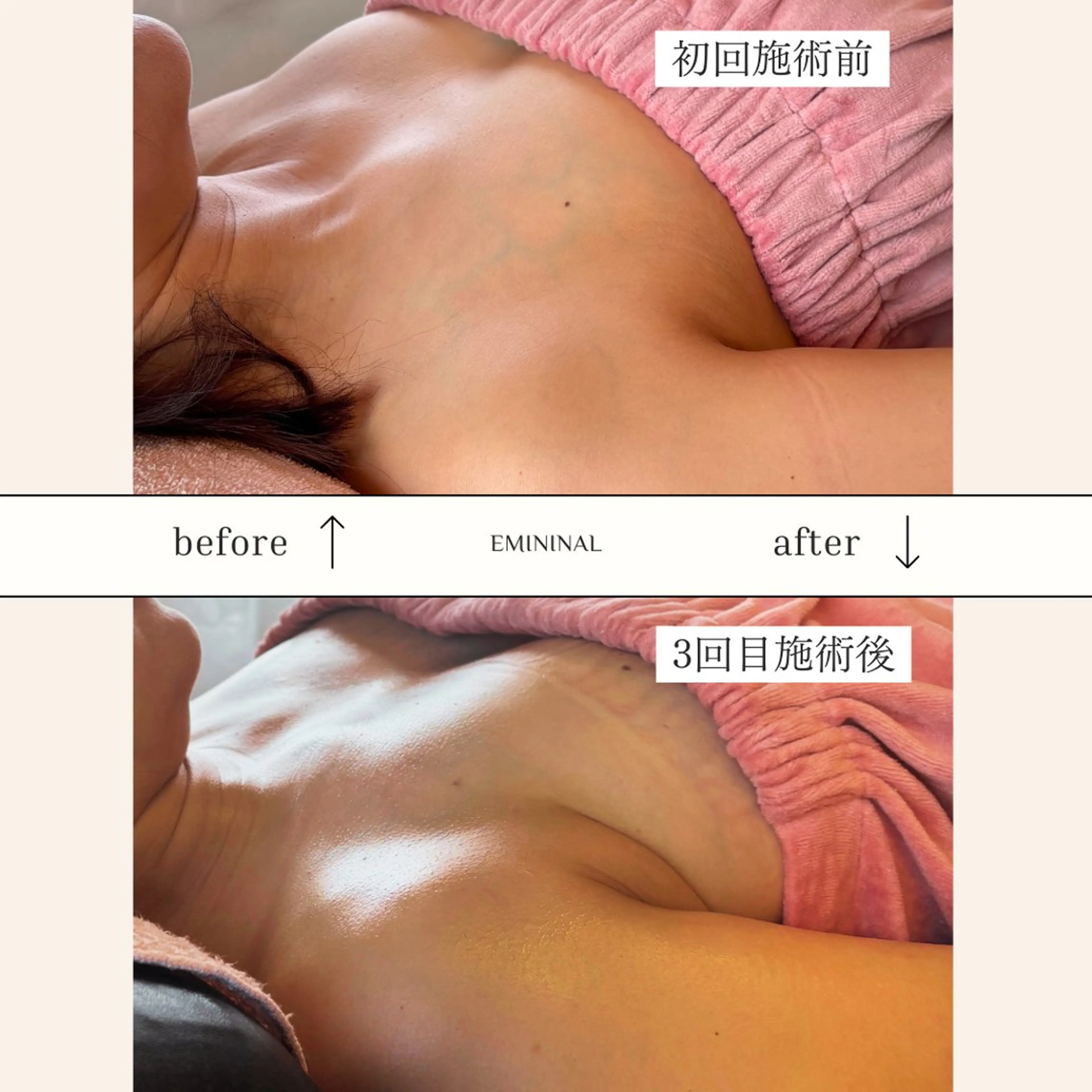 エステ EMININAL salon所属・鈴木 映子のエステ・リラクイメージ