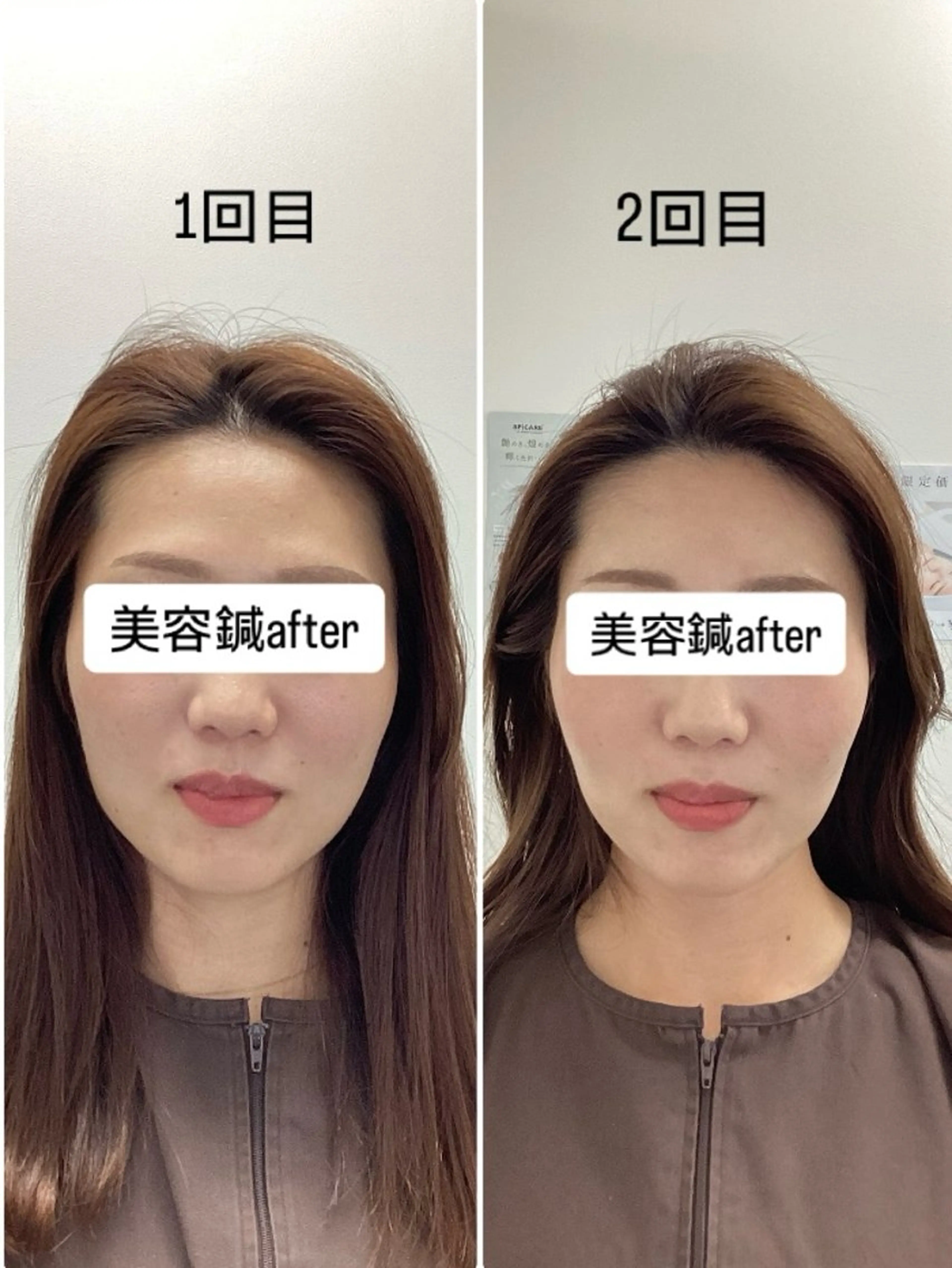 エステ リラク hari salon de off　美容鍼灸×小顔整体【ハリサロンドオフ】所属・美容鍼灸×小顔整体♡ ハリサロンドオフ堺東のエステ・リラクイメージ