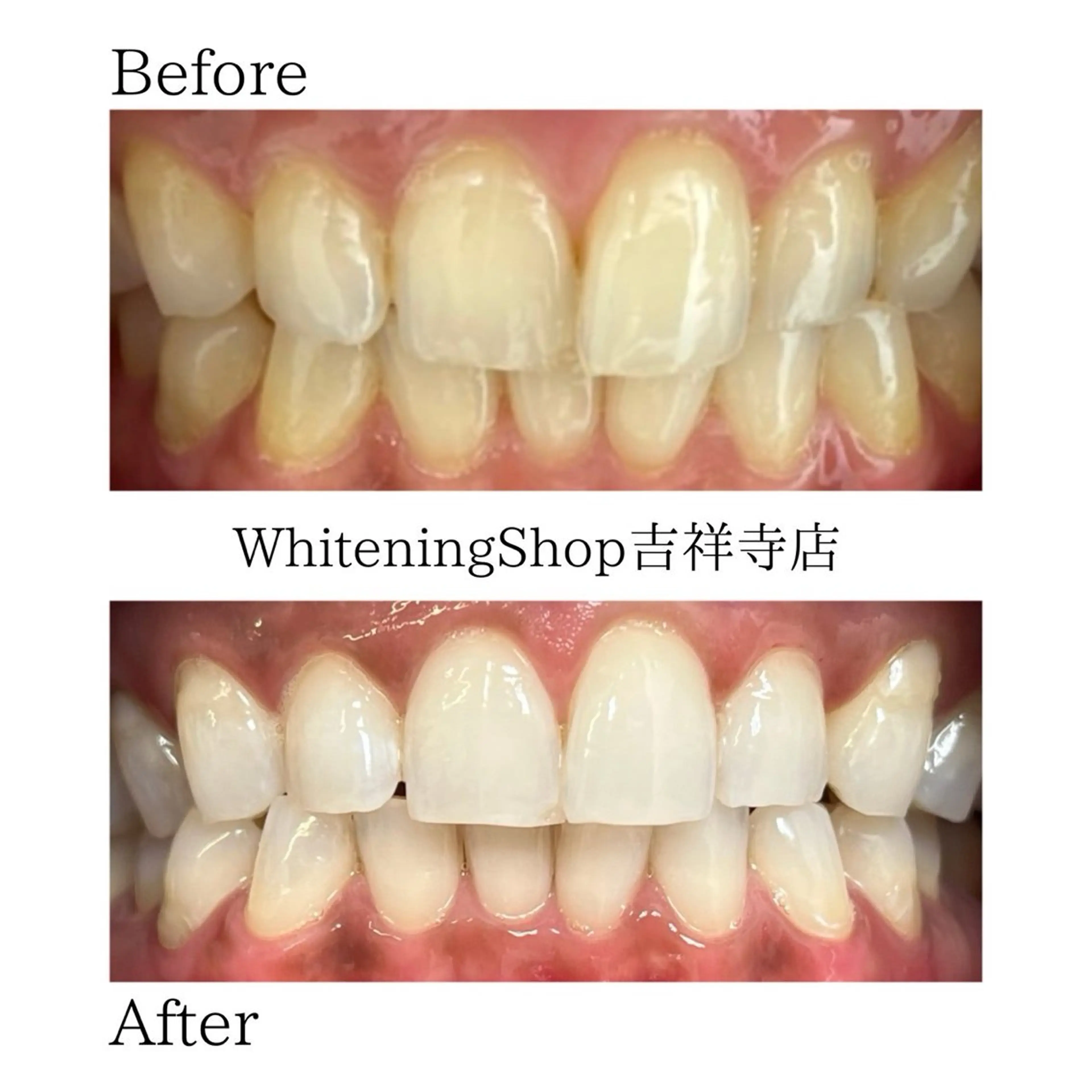 エステ リラク ホワイトニング ショップ吉祥寺店のエステ・リラクイメージ