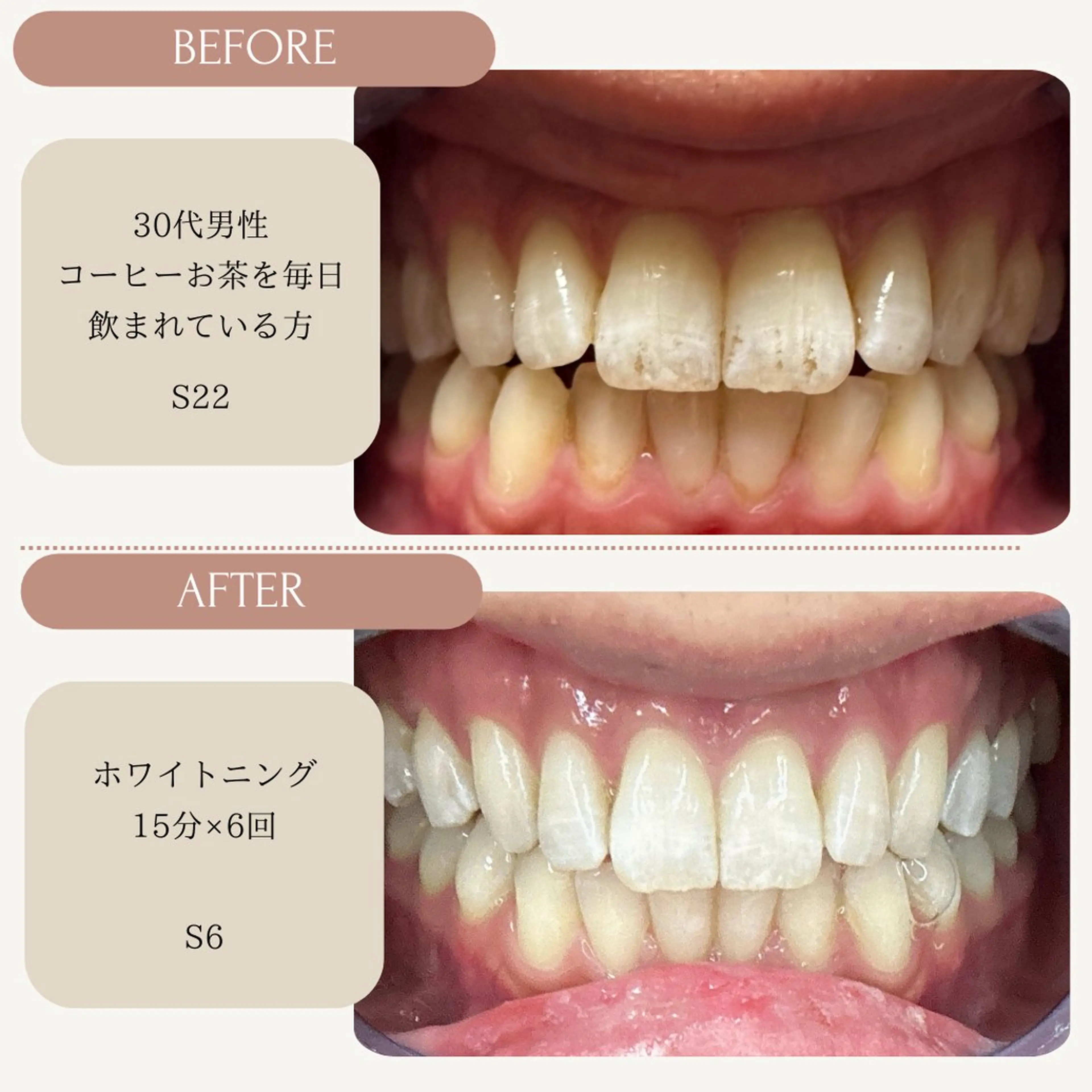 メンズ Whitening Carat 恵比寿店所属・ホワイトニング カラット 恵比寿店のエステ・リラクイメージ