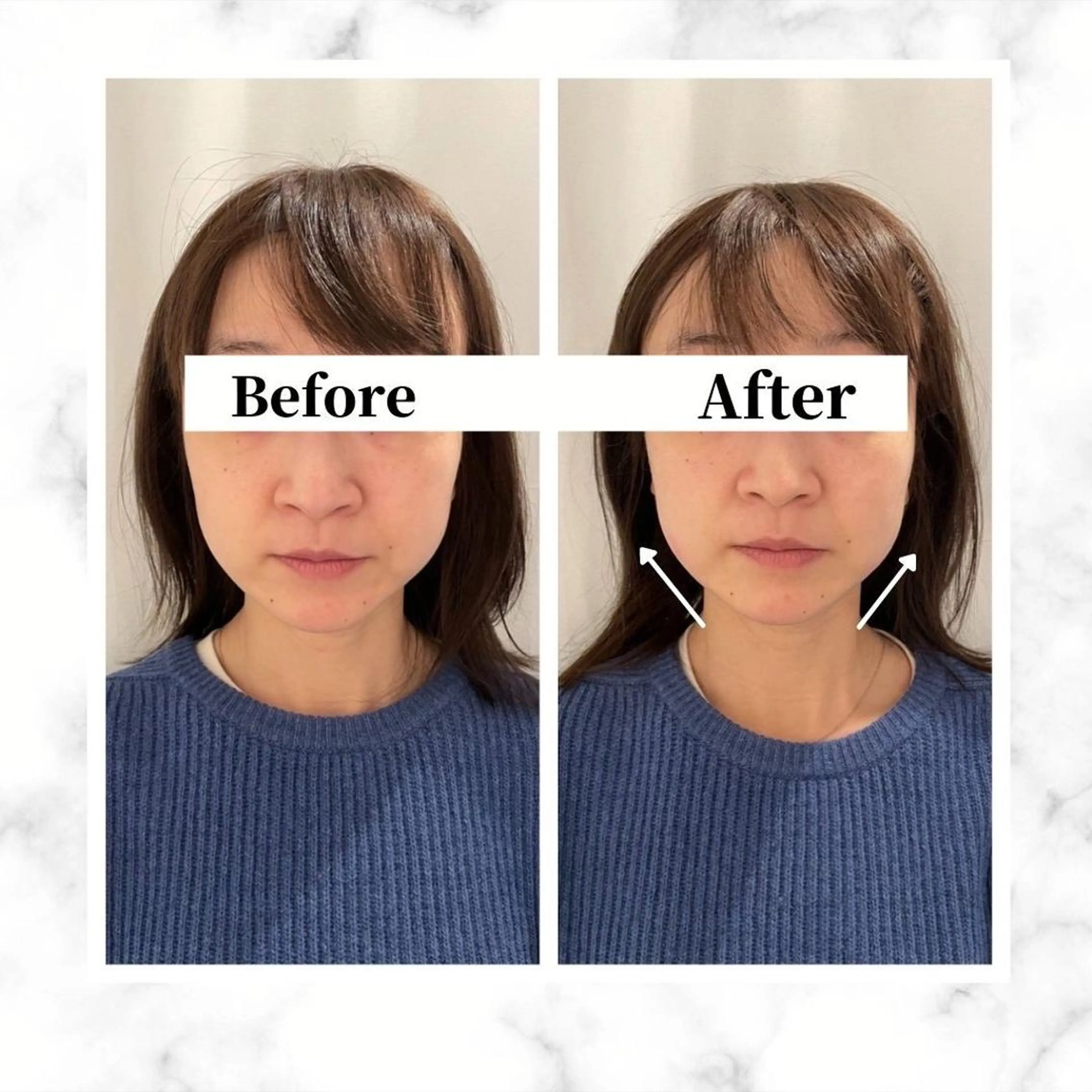 エステ リラク 12Dハイフ💗 最強小顔のエステ・リラクイメージ