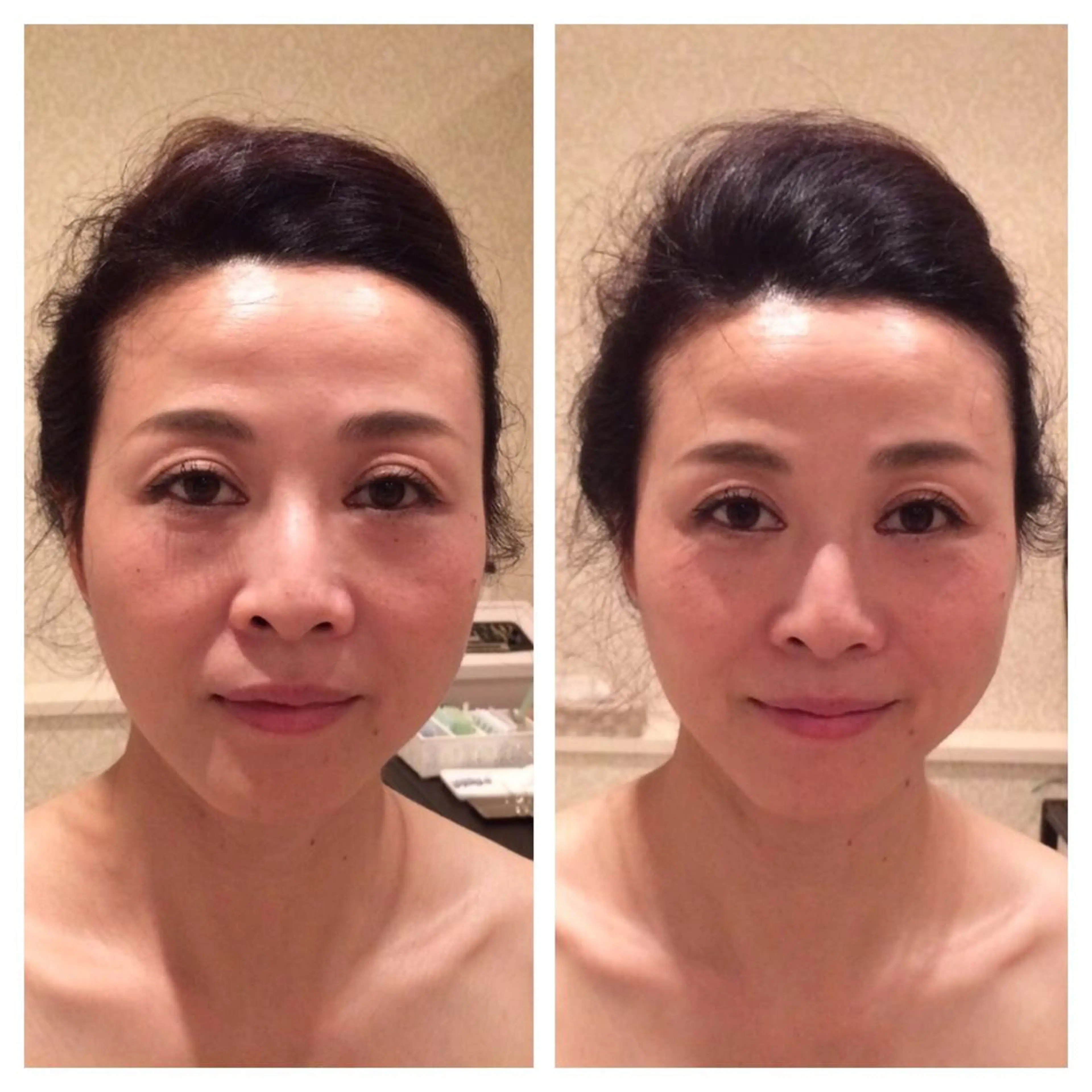 美容鍼サロン    Fleurir所属・伊藤 かなえのエステ・リラクイメージ