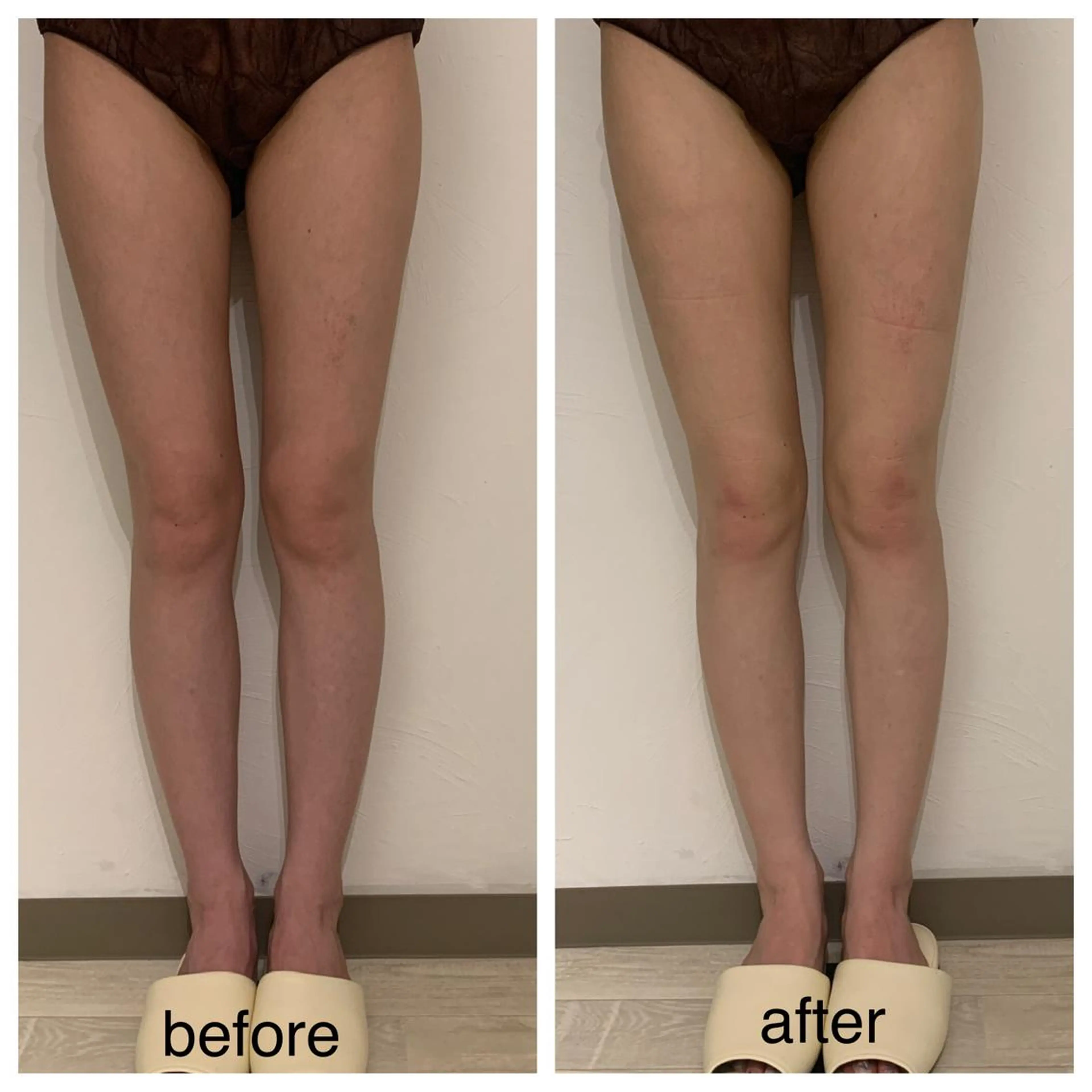 リンパマッサージ&ピラティスmimoza所属・リンパマッサージ mimozaのエステ・リラクイメージ