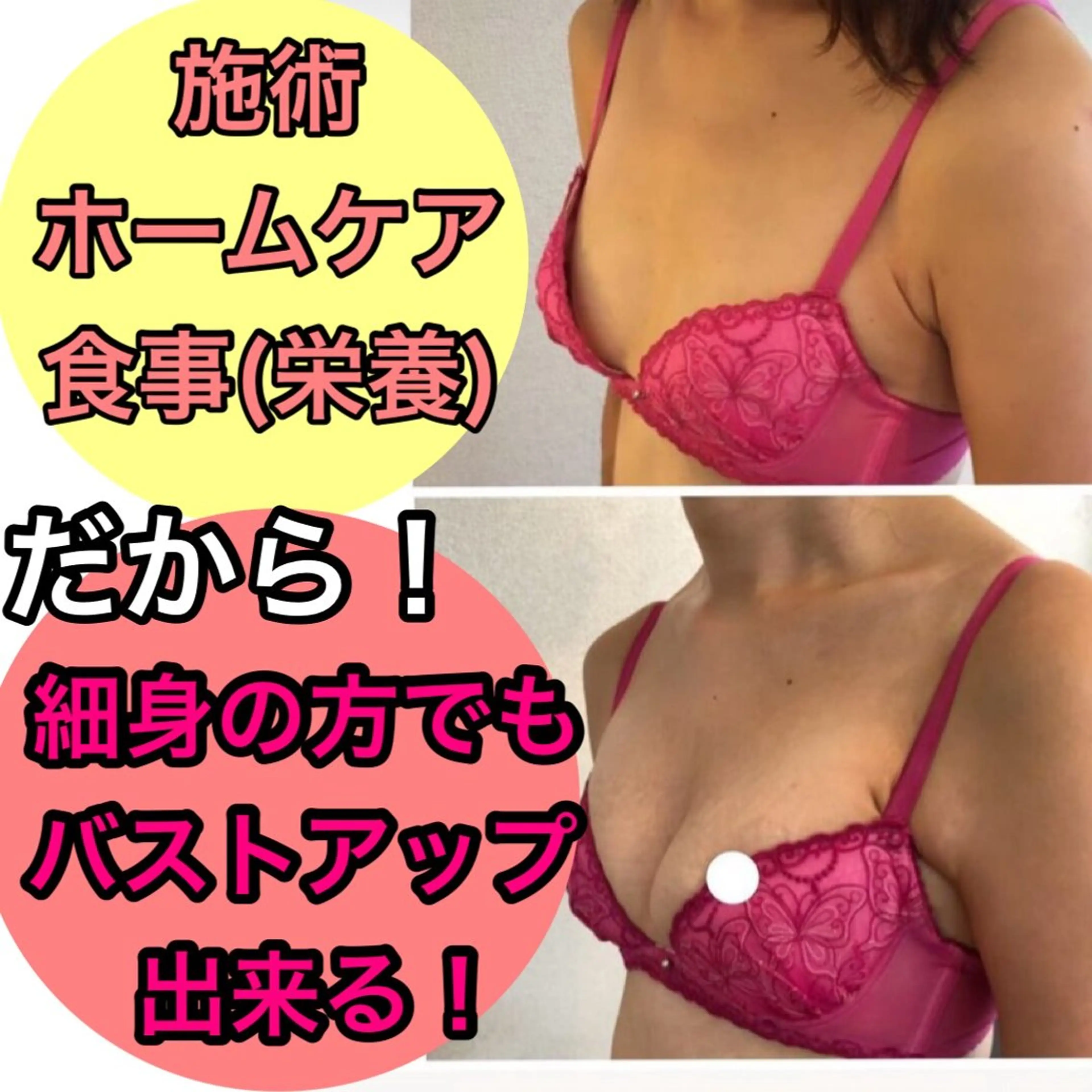 人気No.1【小胸・細身】初めての方にもオススメ◎感動サイズアップコース！の写真