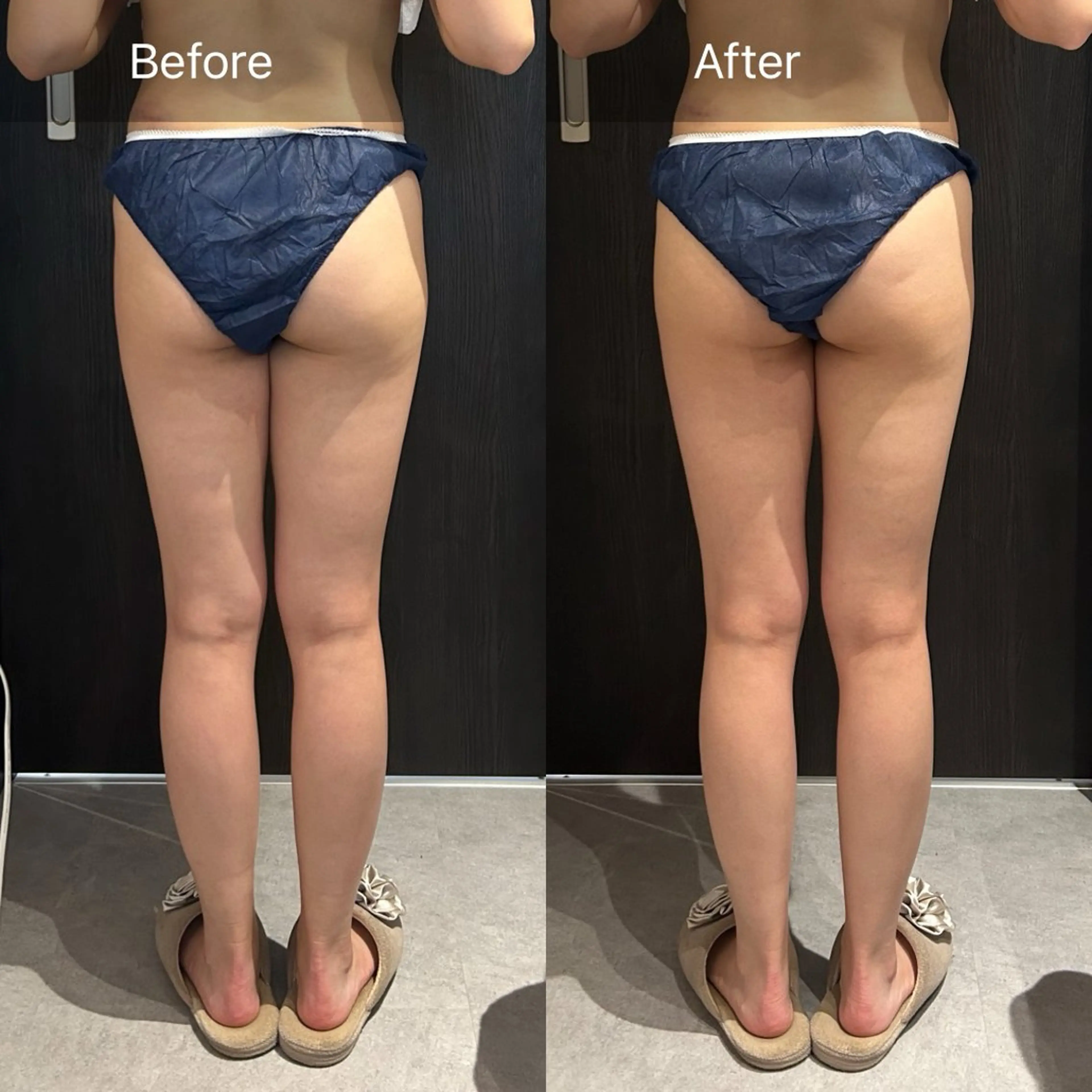 エステ リラク Lune'as Spa南青山所属・Lune'as Spa 南青山のエステ・リラクイメージ