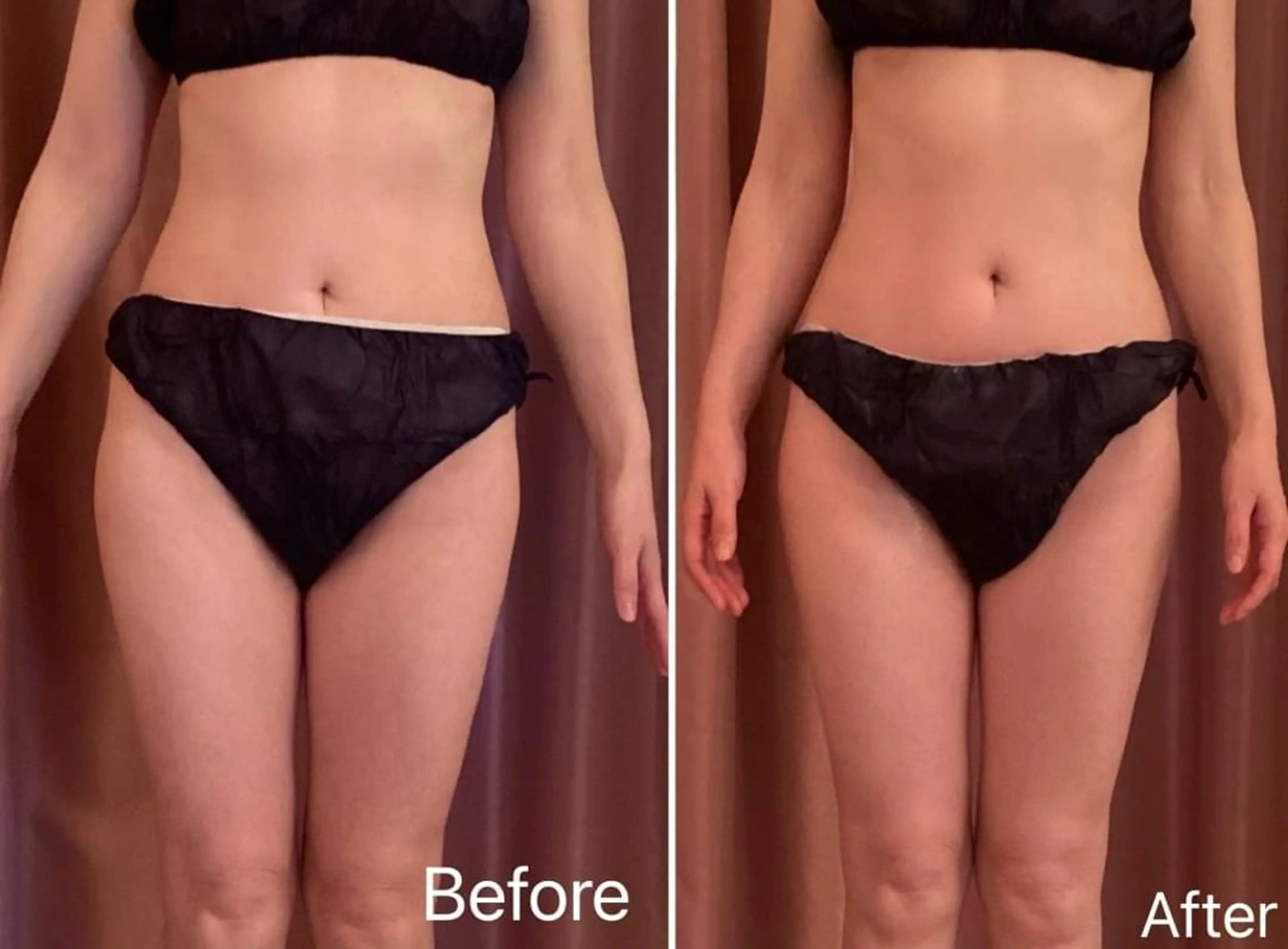 INDIBA Salon Frangipani 新宿所属・INDIBA サロン フランジパニ新宿のエステ・リラクイメージ