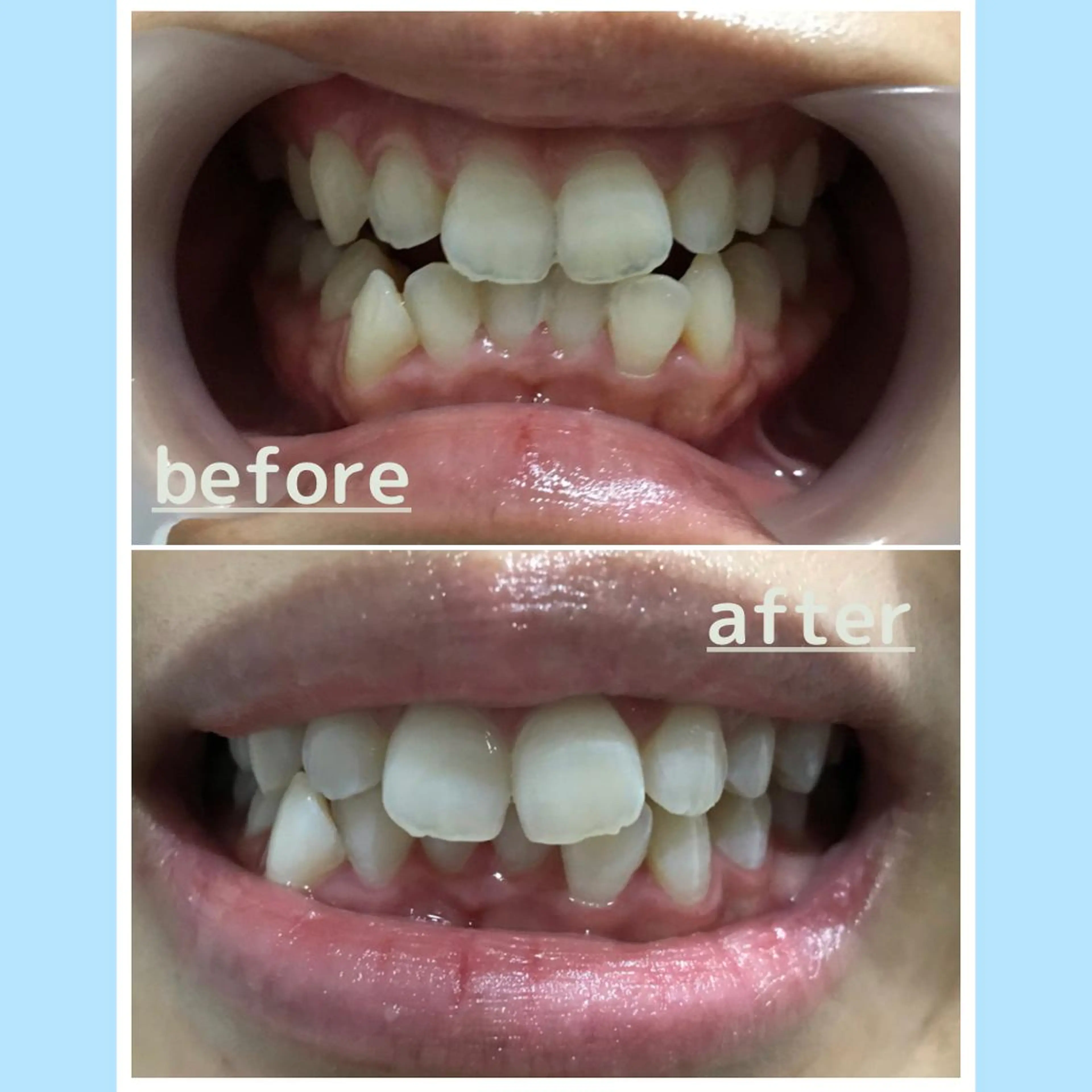 メンズ その他 お手軽ホワイトニングsalon mina所属・武元 奈津美のその他イメージ