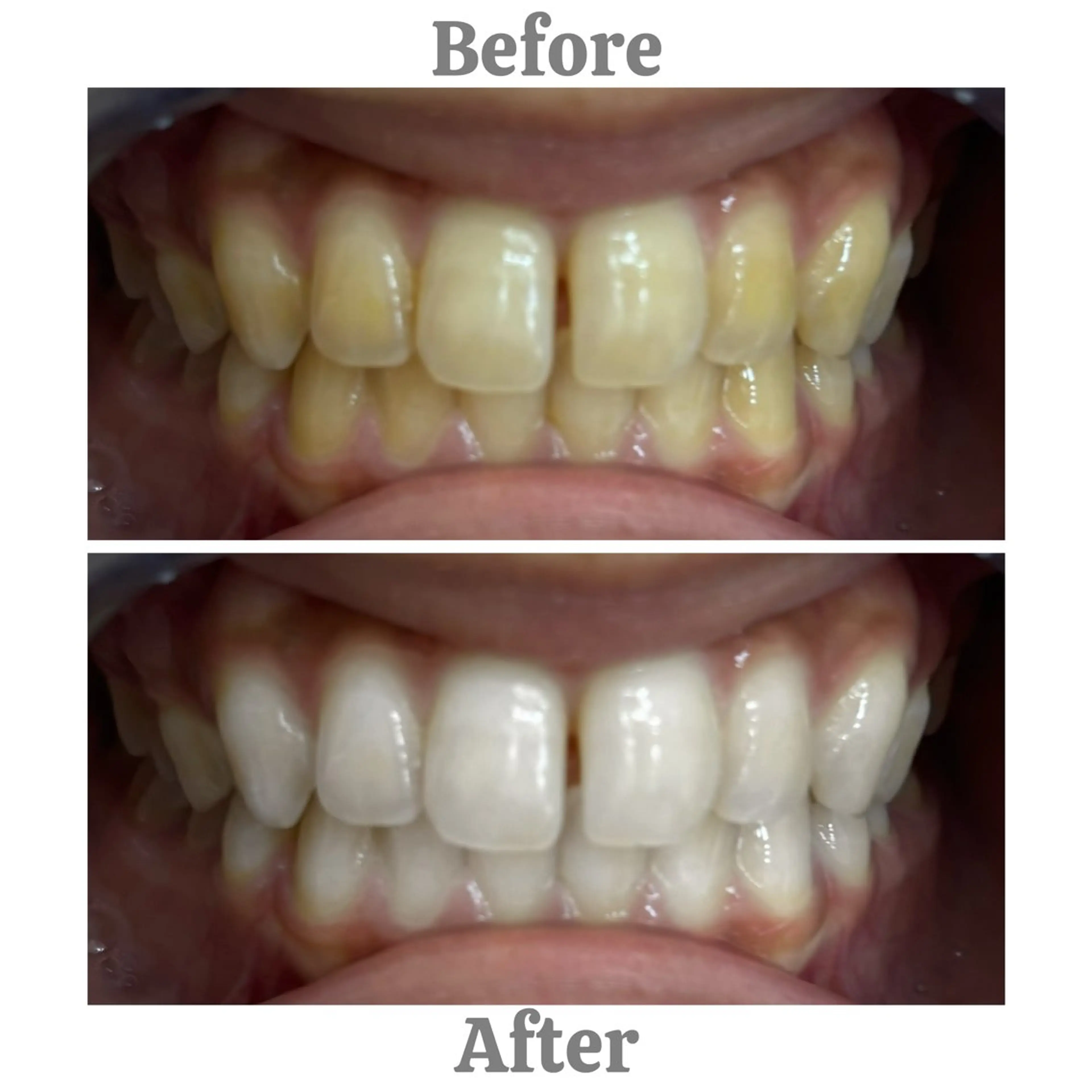 セルフホワイトニング エクシア相模大野店所属・mo moのその他イメージ