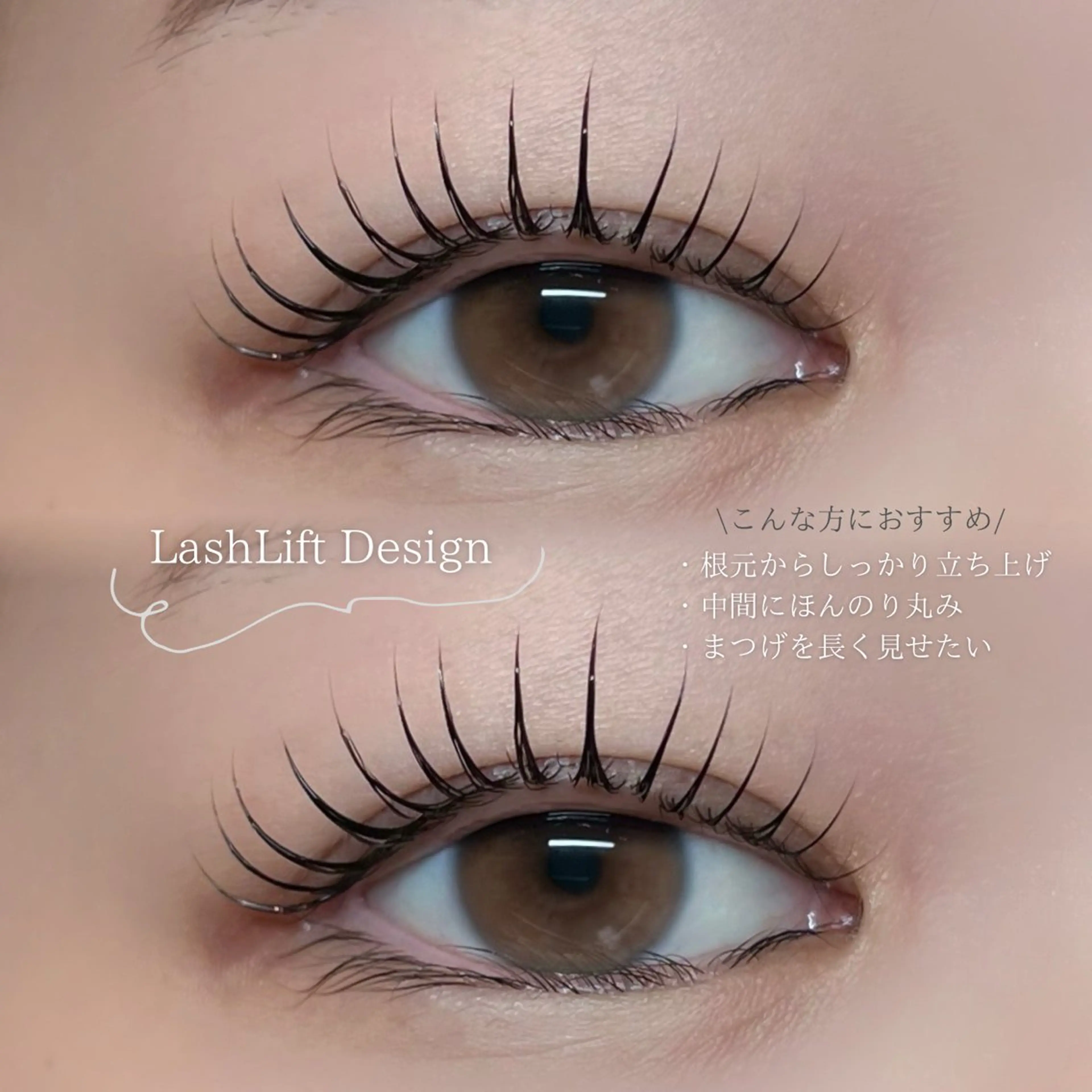 【3週間集中ケア】幹細胞トリートメント(D-MAX)付きラッシュリフトの写真