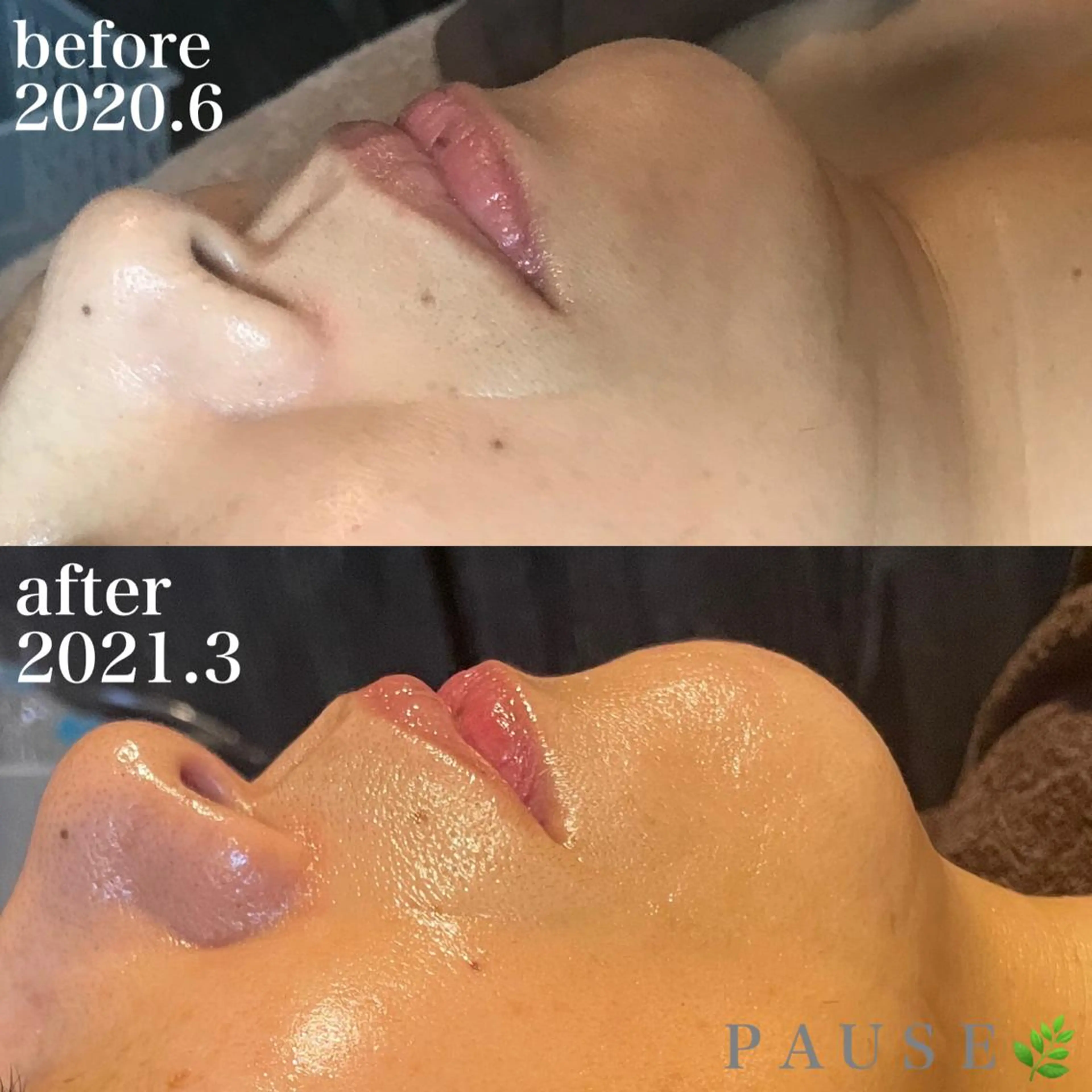 エステ 浜野 恵美のエステ・リラクイメージ