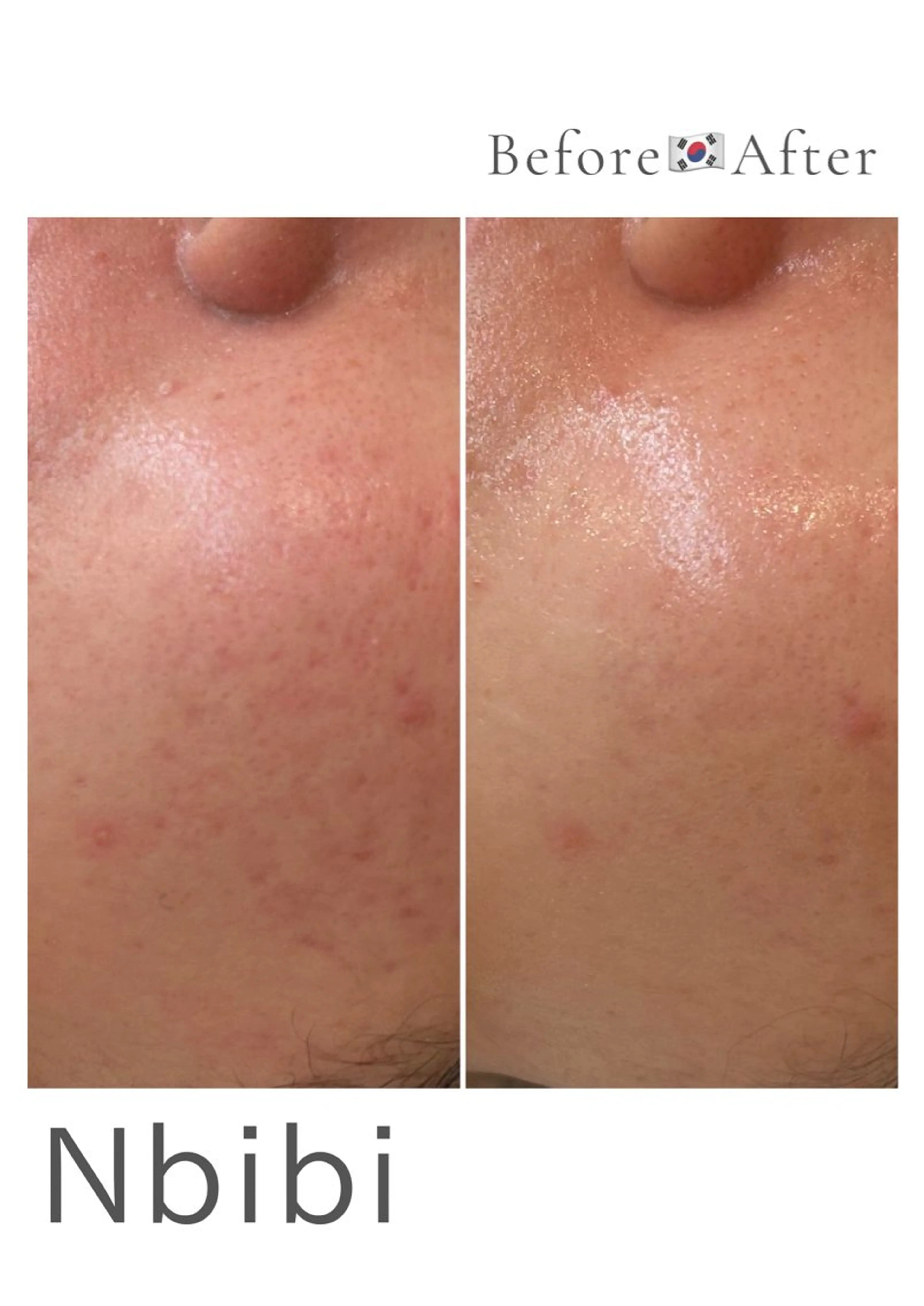 韓国🇰🇷価格 サロン_Nbibiのエステ・リラクイメージ