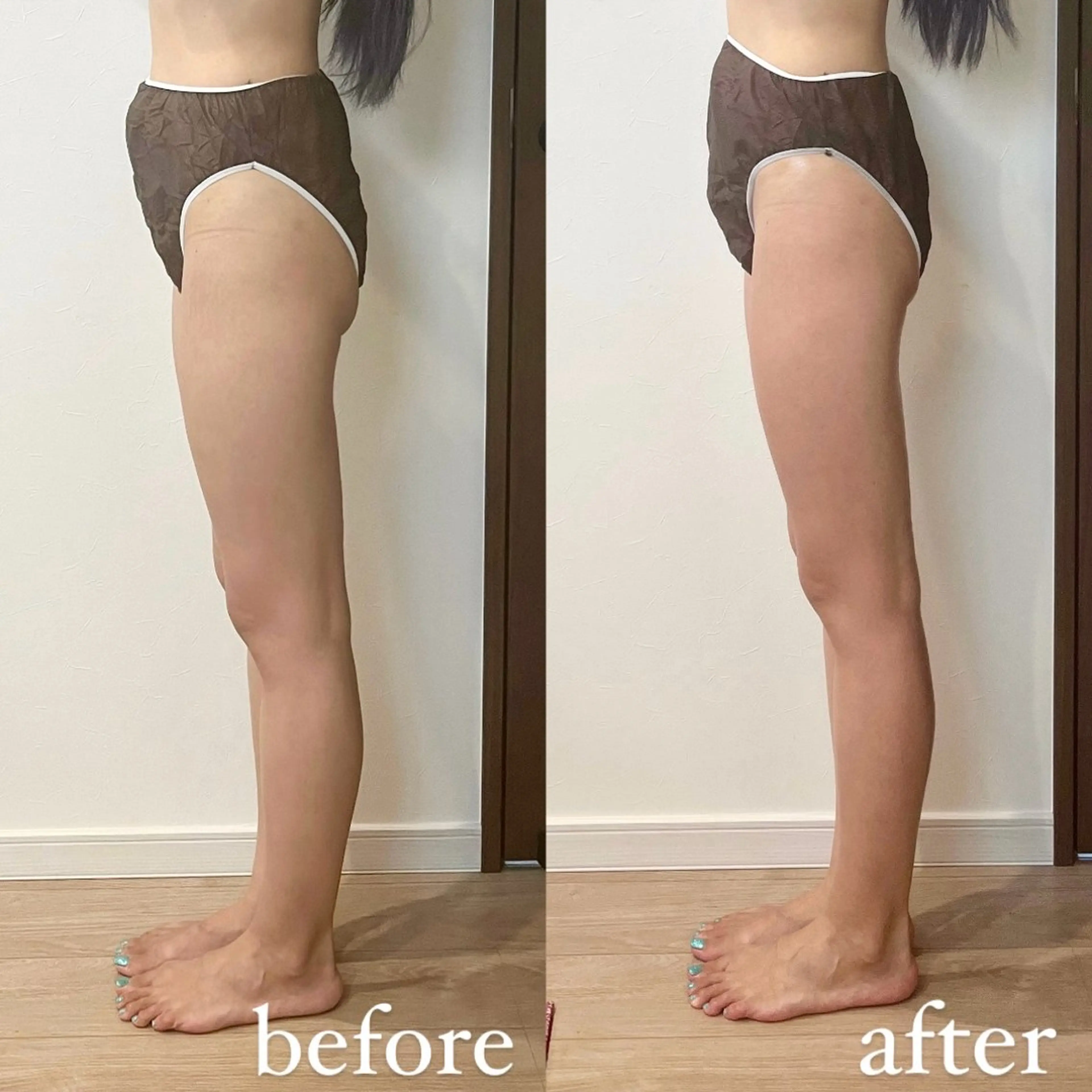 美脚になりたい🧡コルギの写真