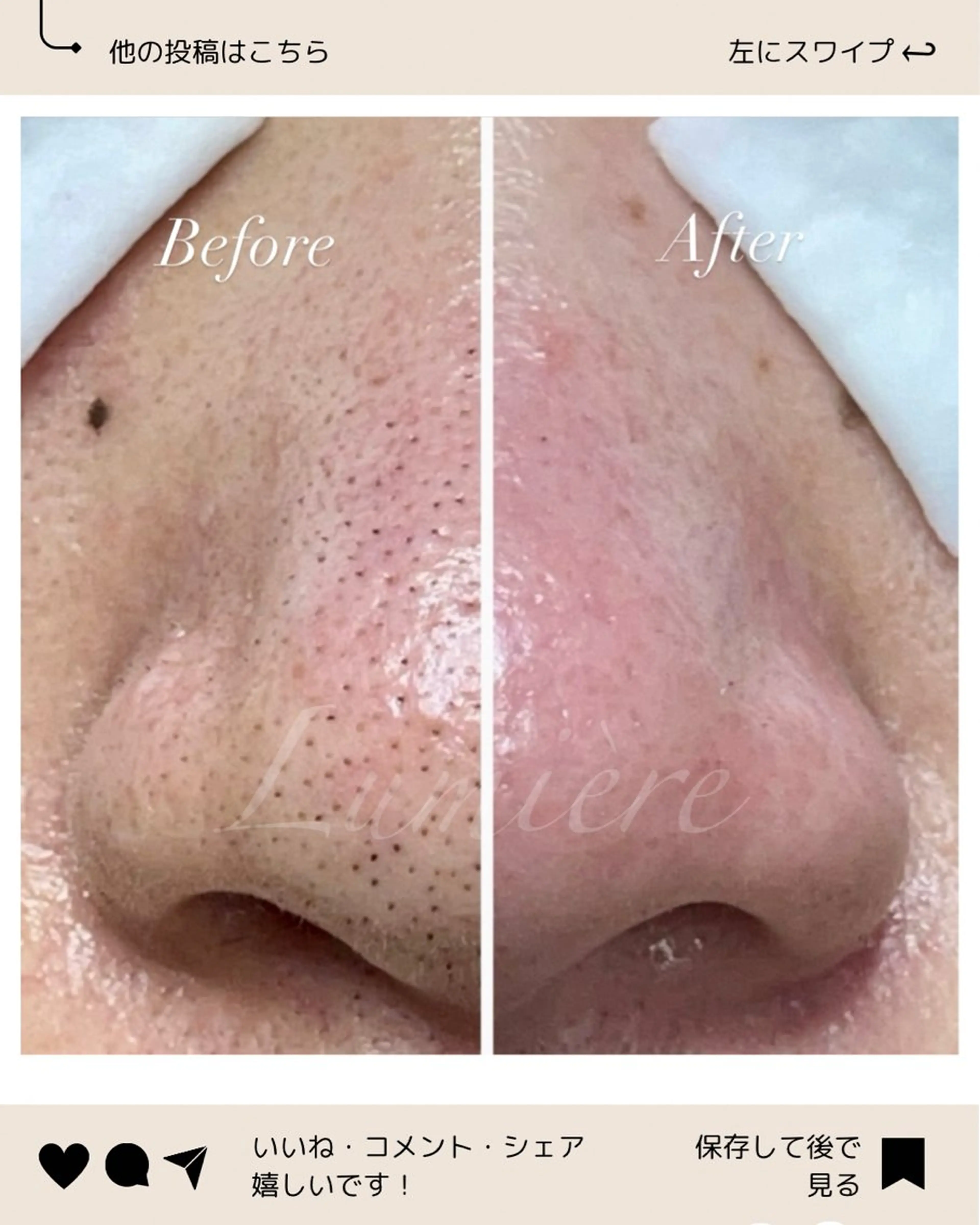 エステ マツヤニワックス専門 堂山町 ルミエールのエステ・リラクイメージ