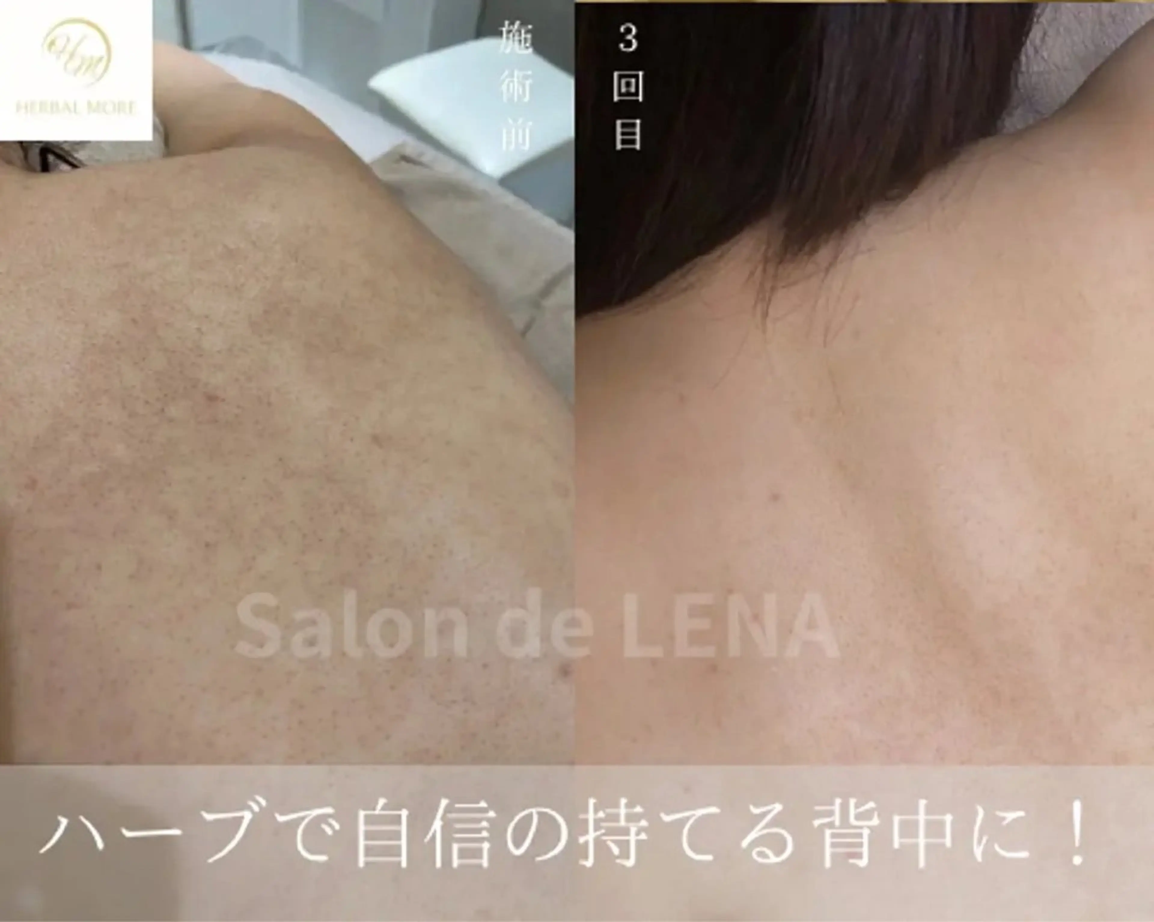 Grandir所属・ハーブピーリング専門 グランディール　武内のエステ・リラクイメージ