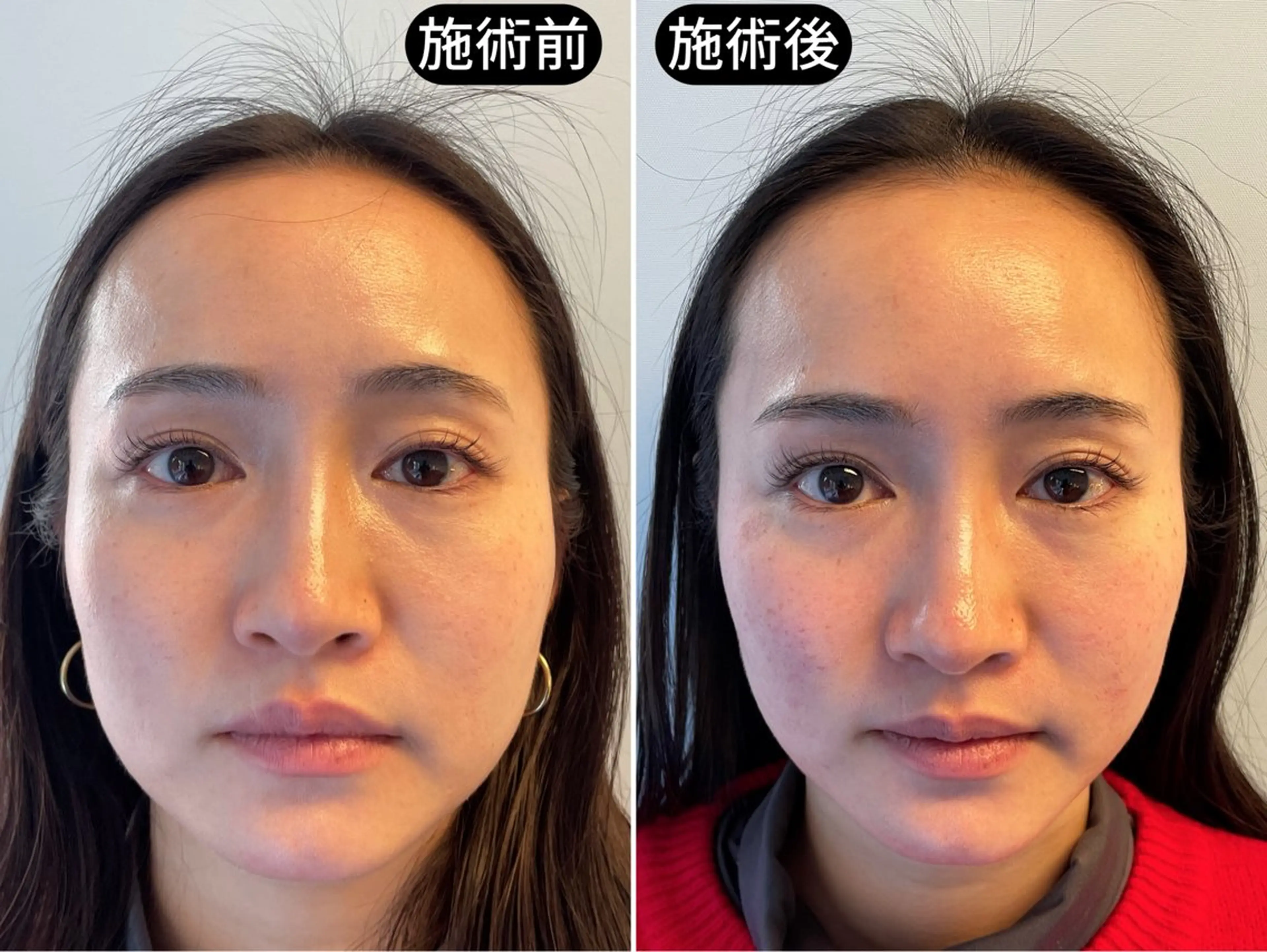 リラク 渋谷 小顔美容鍼 専門サロン YZのエステ・リラクイメージ