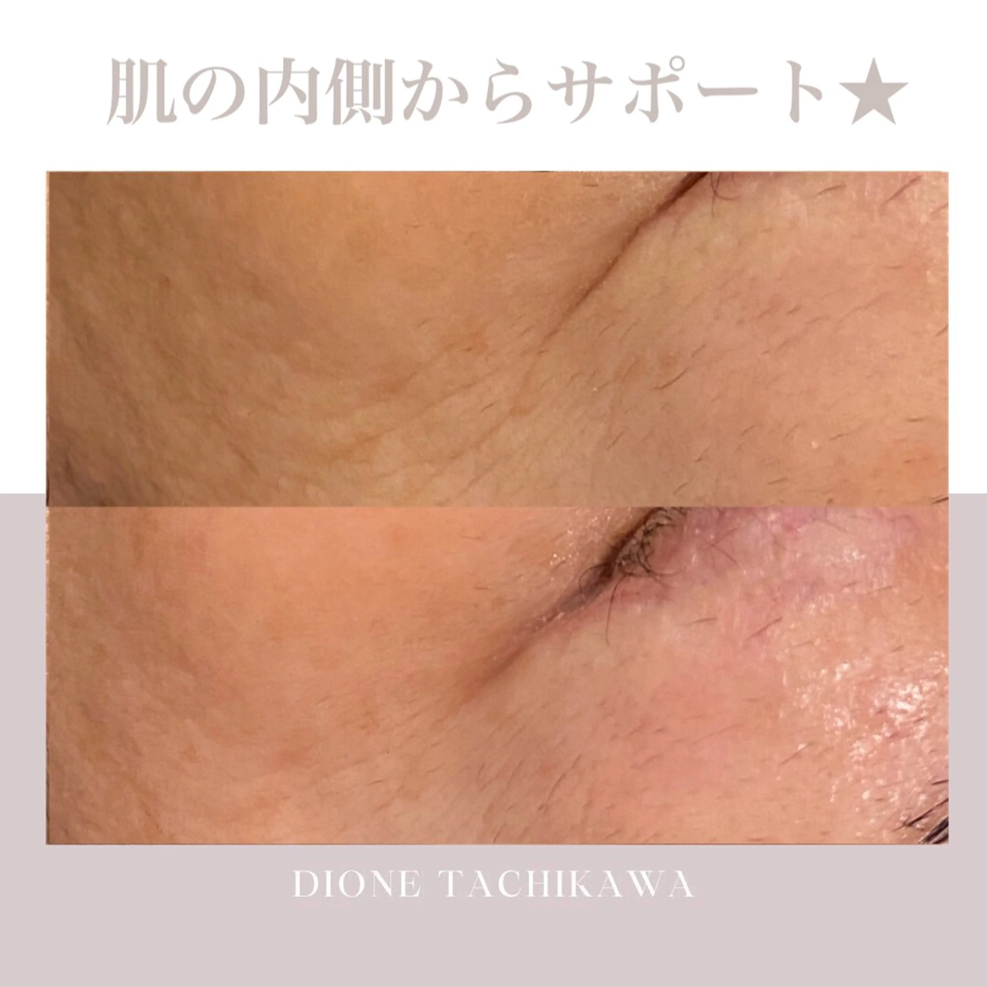 エステ 【リベルハーブピーリング認定店】敏感肌・美白脱毛専門店Dione立川店所属・Dione 立川店のエステ・リラクイメージ