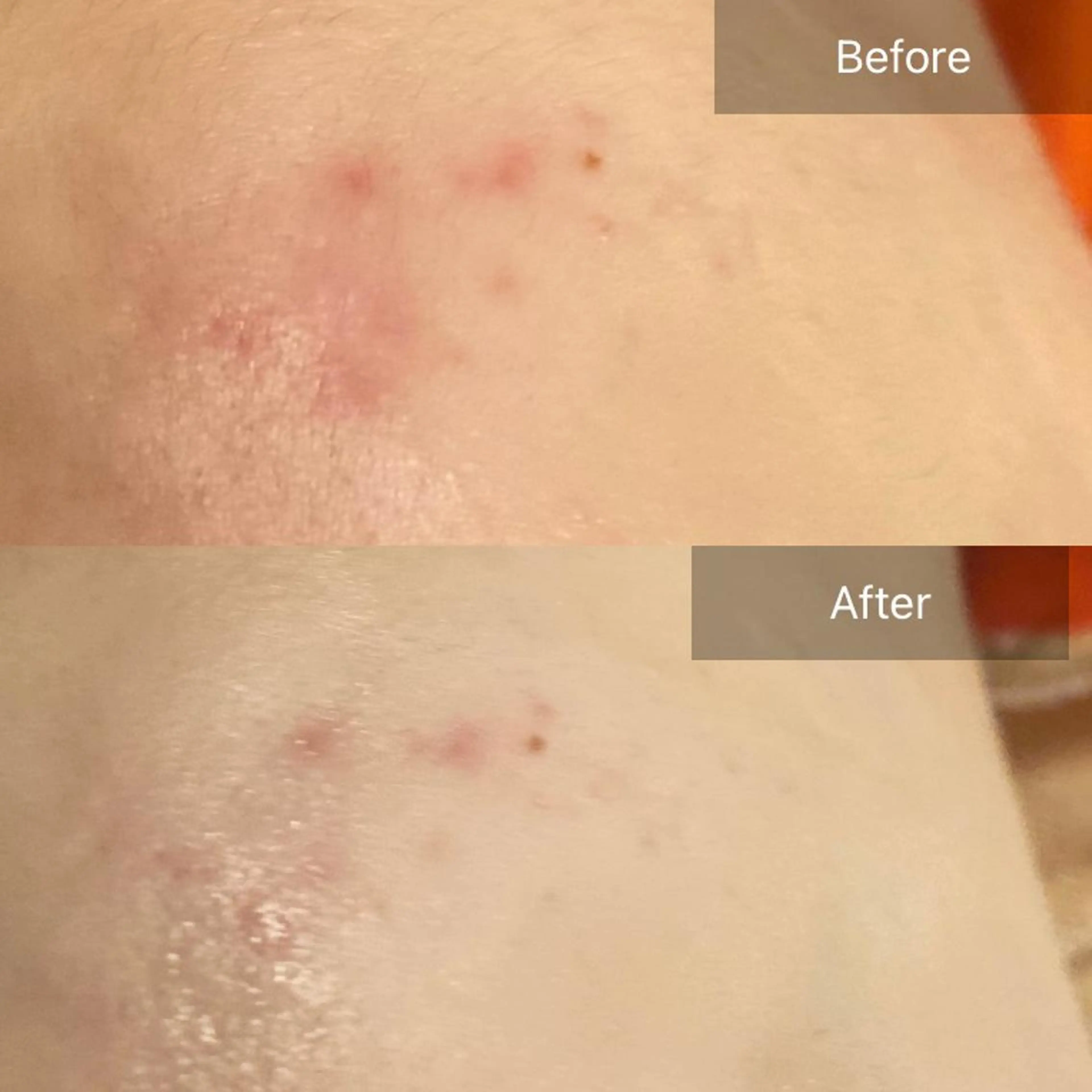 Mandarin Orange所属・毛穴から始める肌メン テマンダリンオレンジのエステ・リラクイメージ