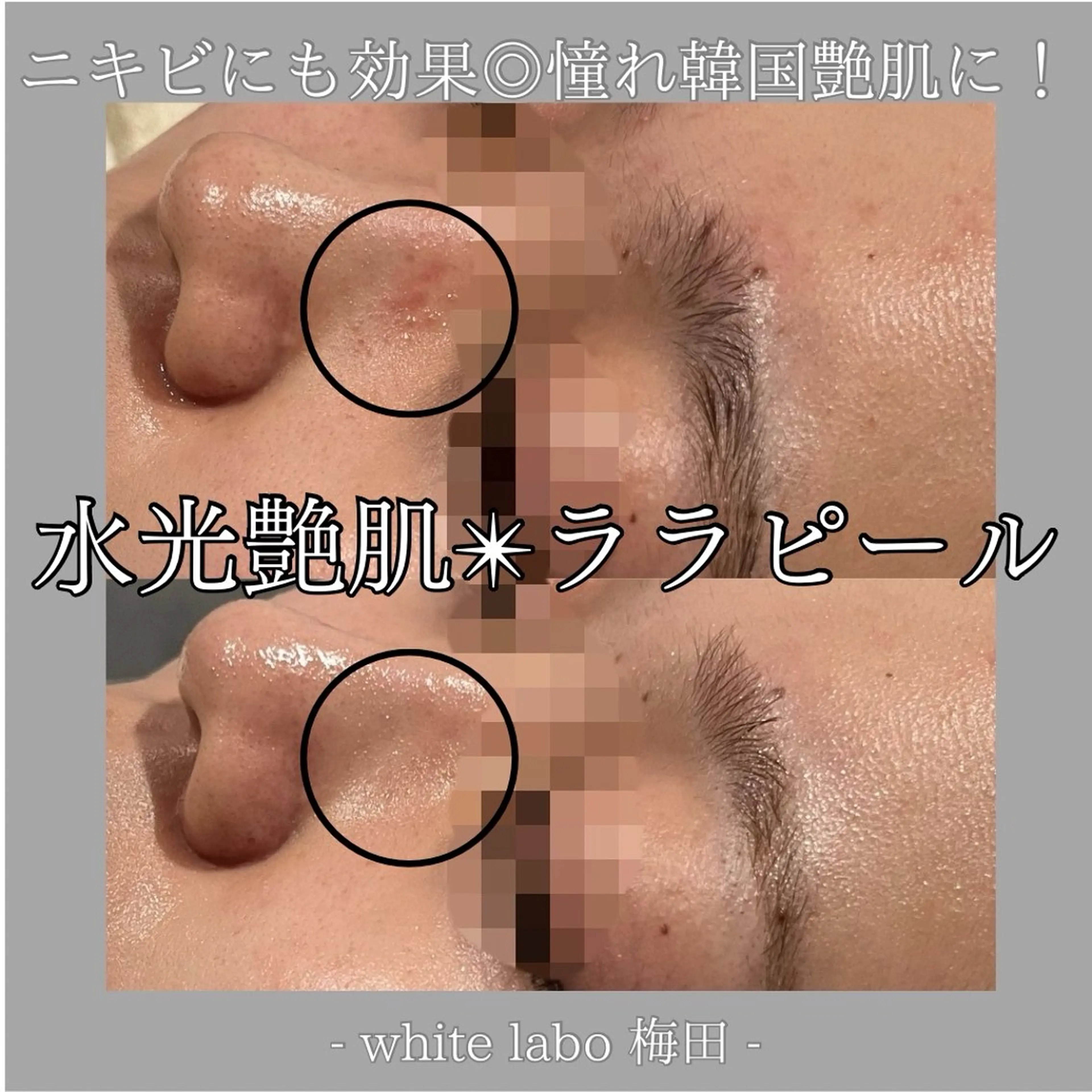 韓国肌管理専門店　White labo 梅田店所属・大西 亜季のエステ・リラクイメージ