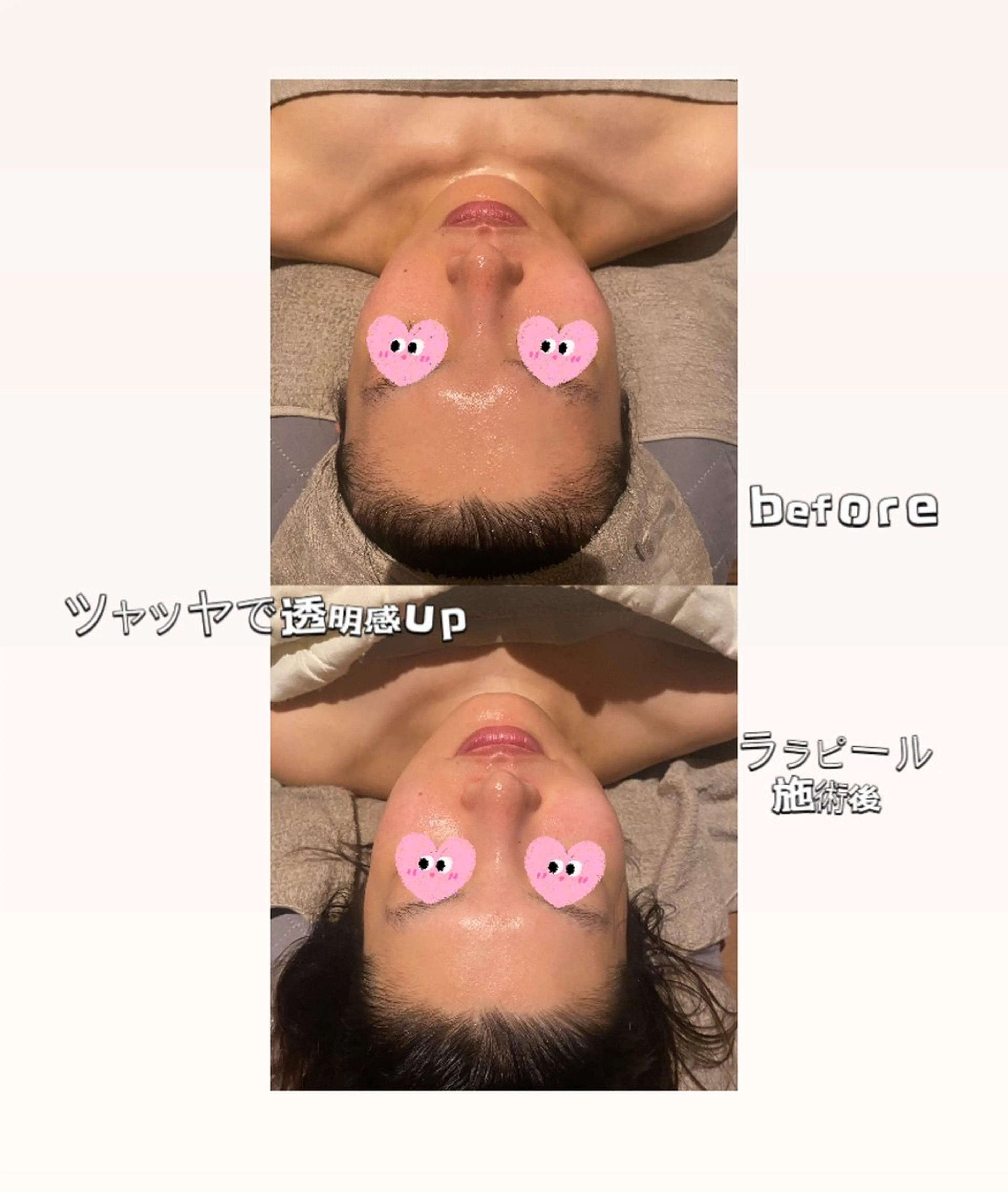 🧚‍♀️優来 リラク痩身肌質改善のエステ・リラクイメージ