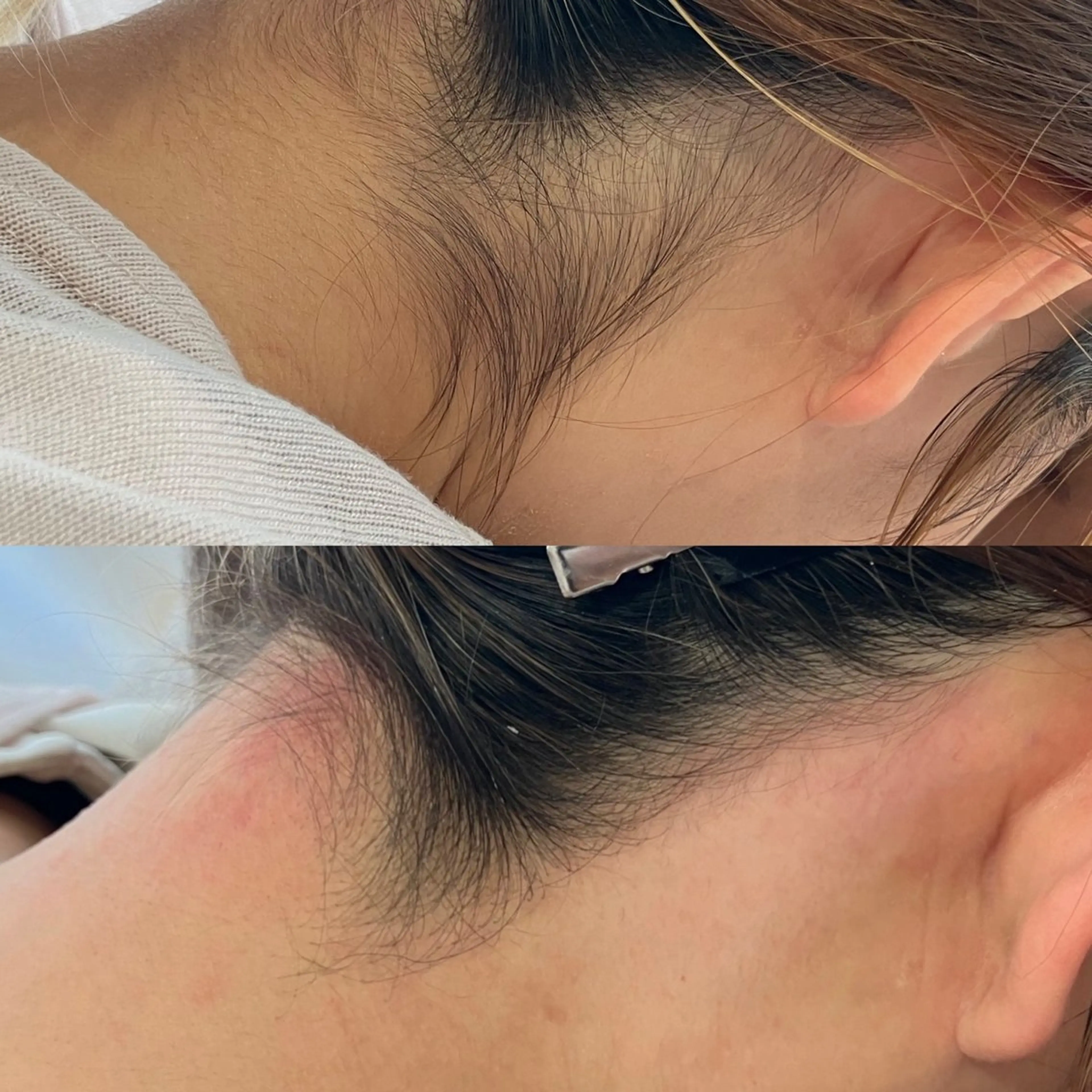 脱毛 Felimor.所属・Felimor. フェリモールのエステ・リラクイメージ