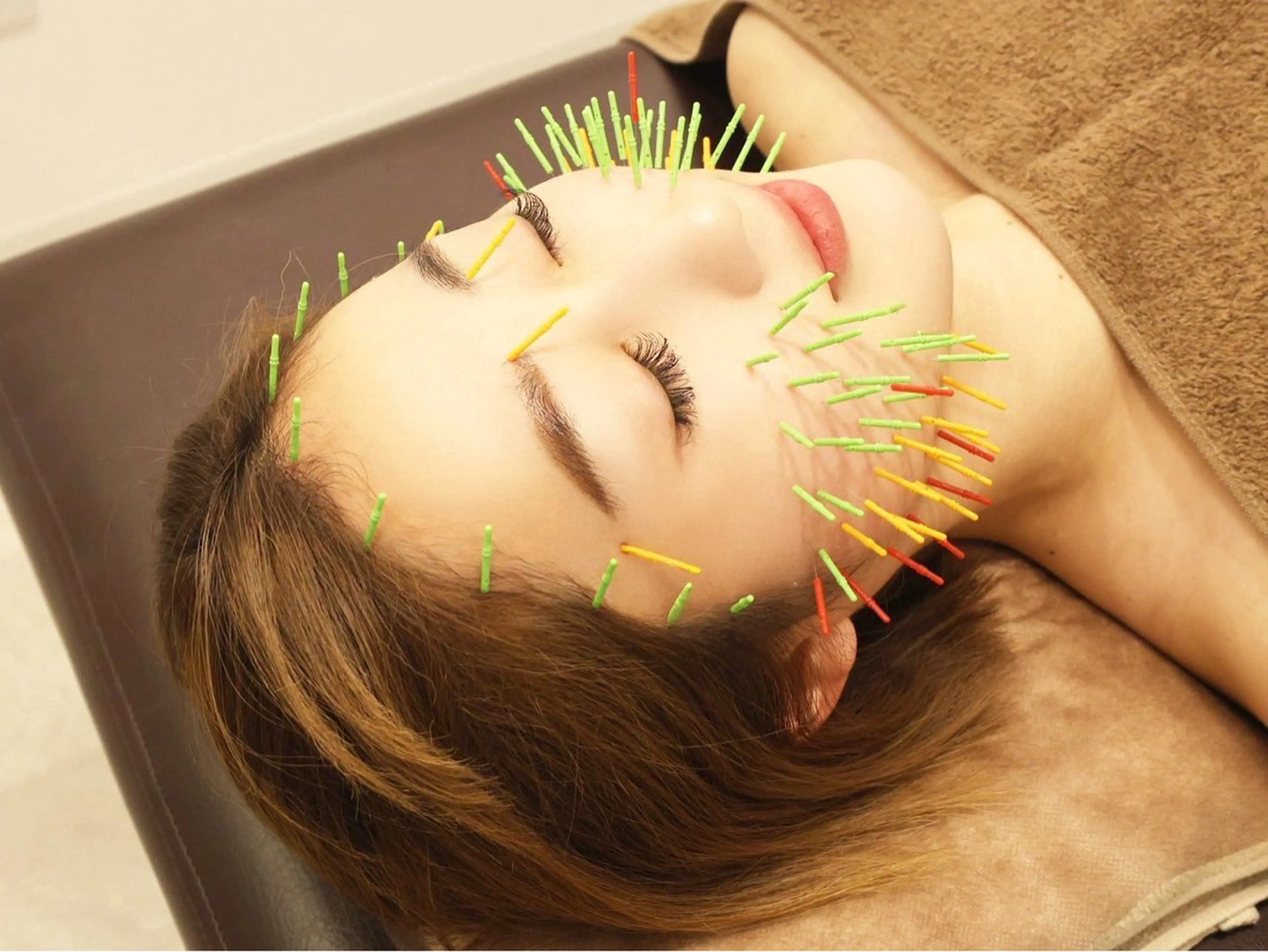 エステ リラク 美容鍼灸Solana所属・肌質改善×美容鍼 ゆいのエステ・リラクイメージ