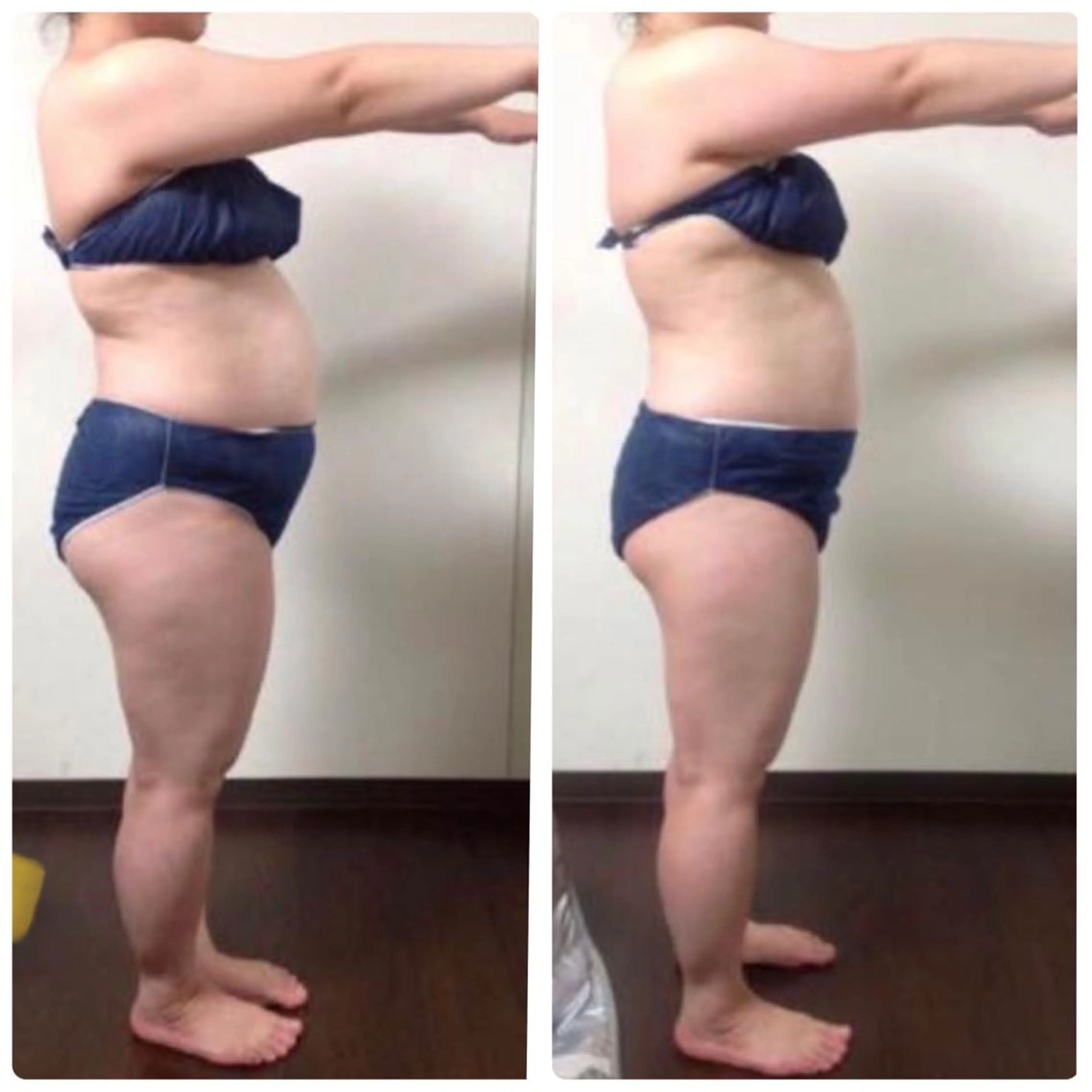 オーダーメイド痩身【1回90分】¥18,970→¥4,980の写真