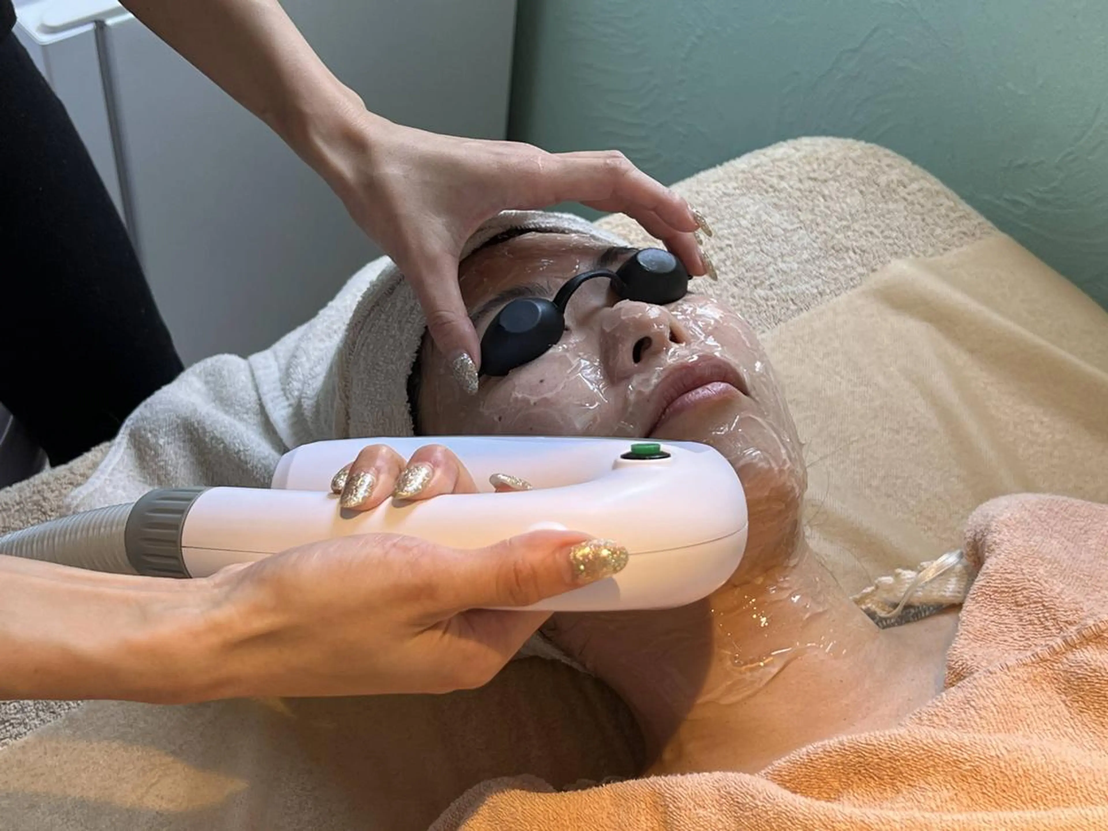 ☆ニキビ、シミ、乾燥☆フォト光フェイシャルの写真