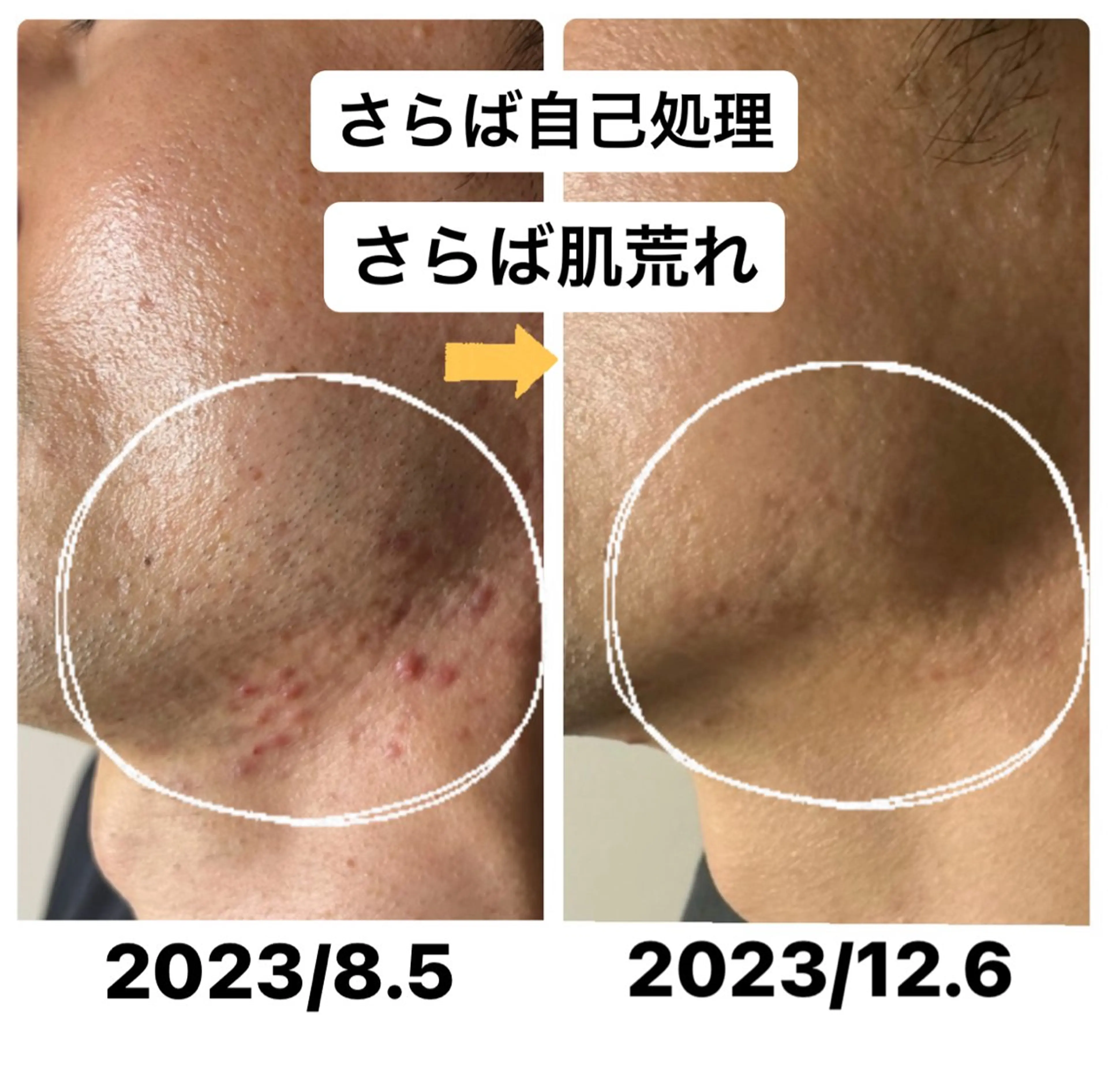 メンズ 脱毛 メンズ脱毛サロン Le falcoのエステ・リラクイメージ