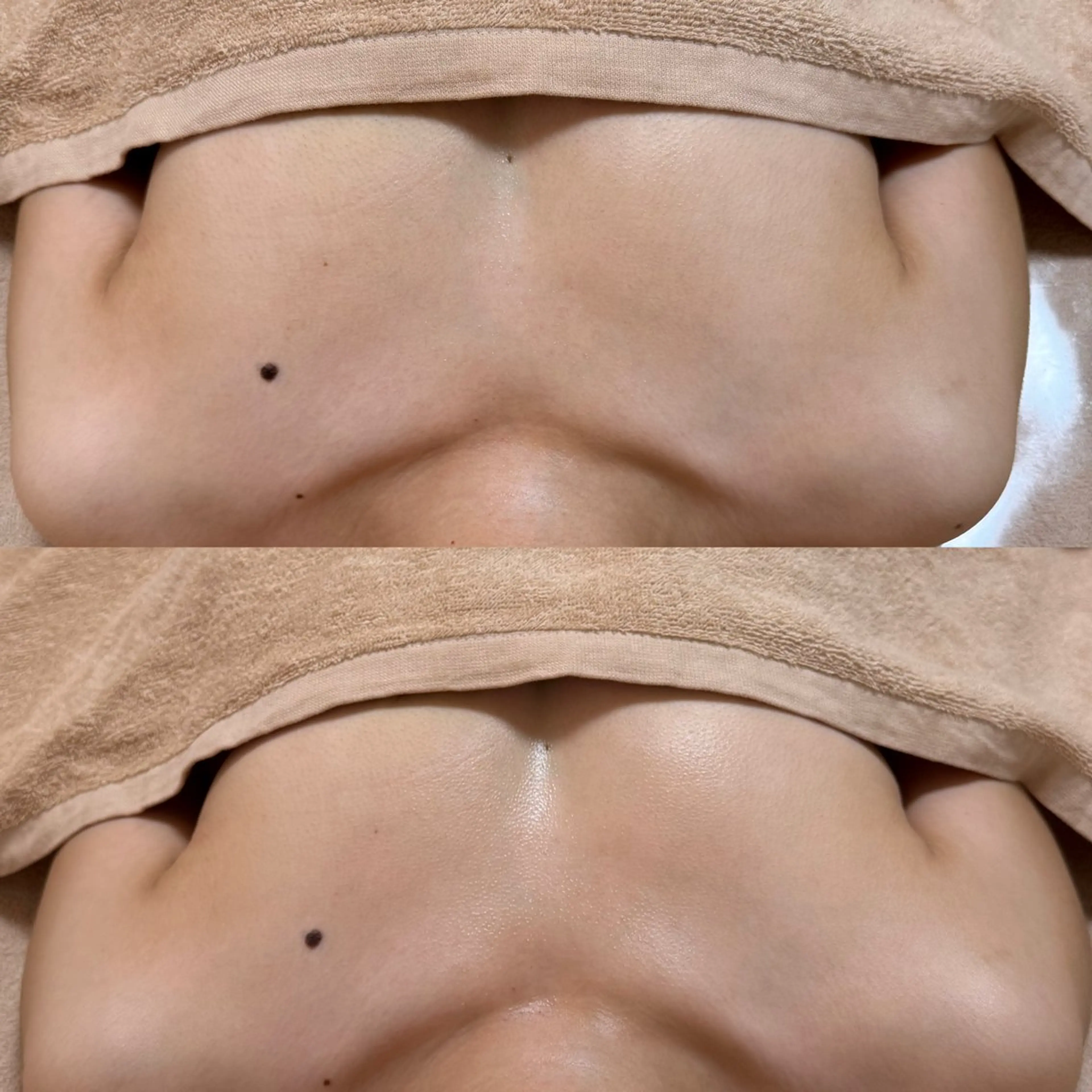 女性ホルモン整え！バストアップ×オイル×亜鉛の写真